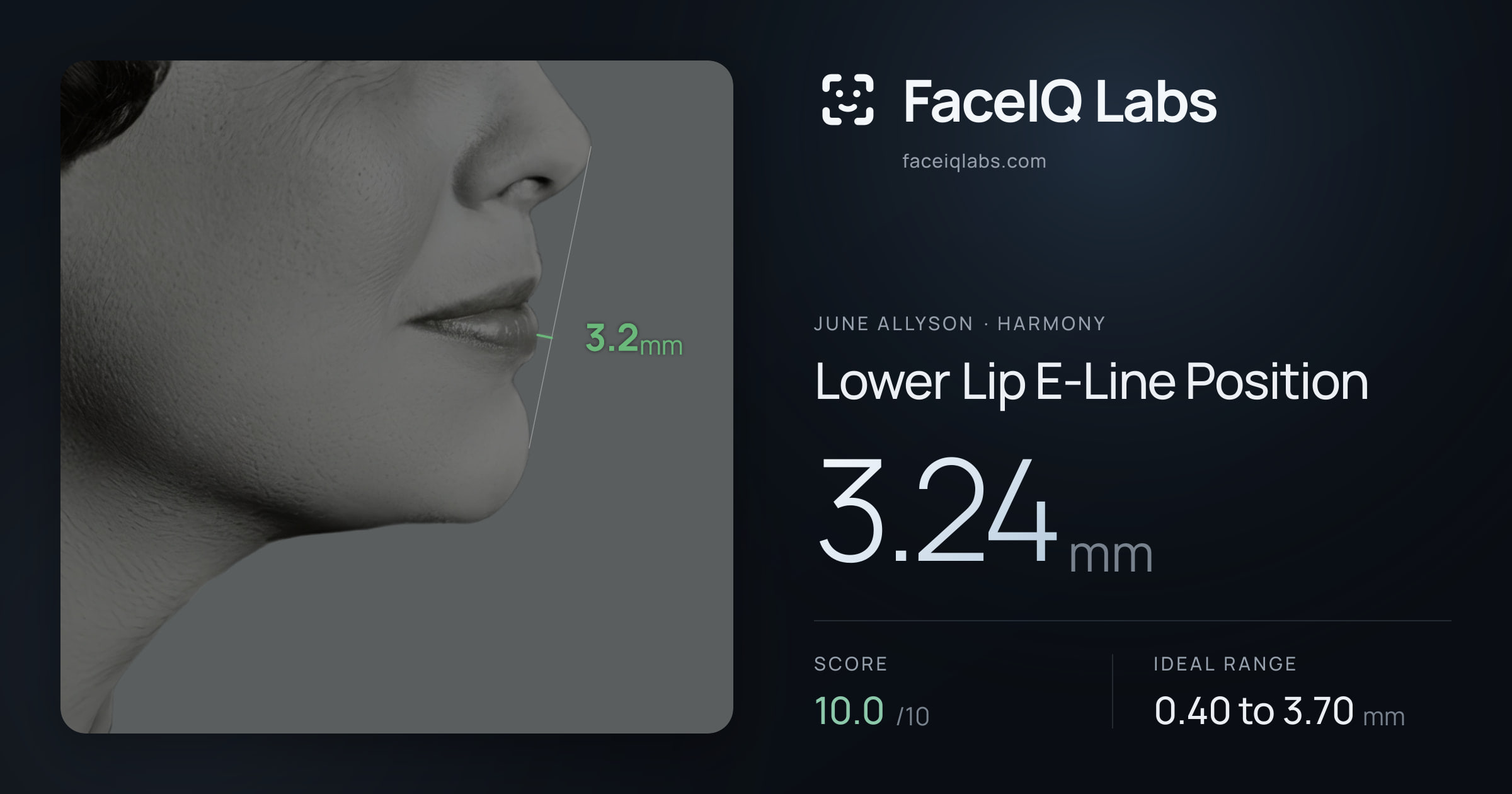 June Allyson Lower Lip E-Line Position: 3.24mm, drawn on the photo