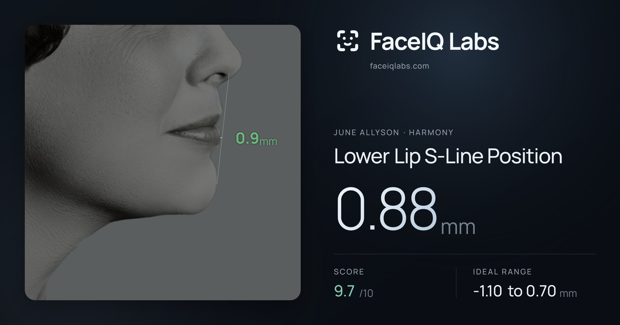 June Allyson Lower Lip S-Line Position: 0.88mm, drawn on the photo