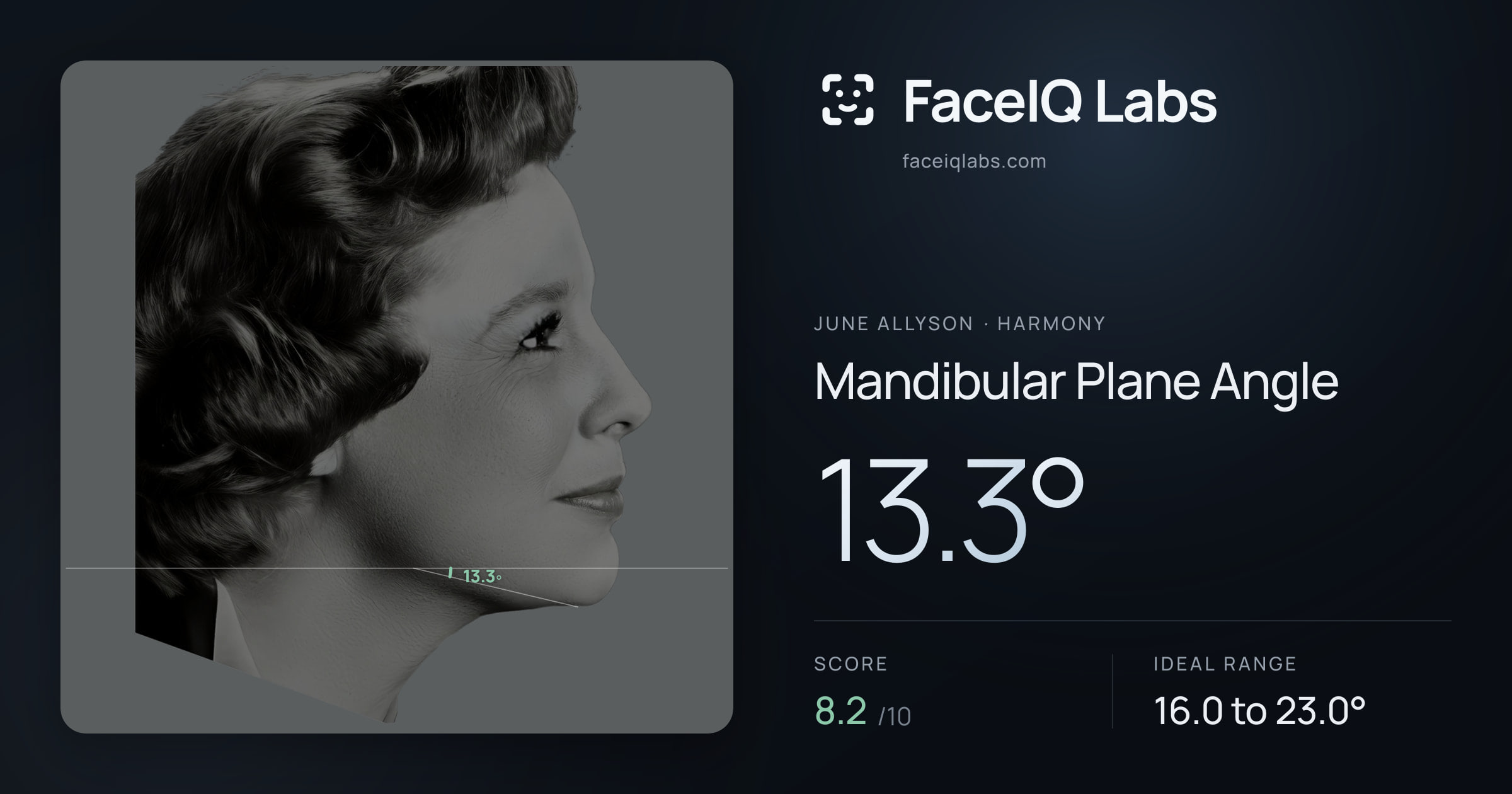 June Allyson Mandibular Plane Angle: 13.3°, drawn on the photo