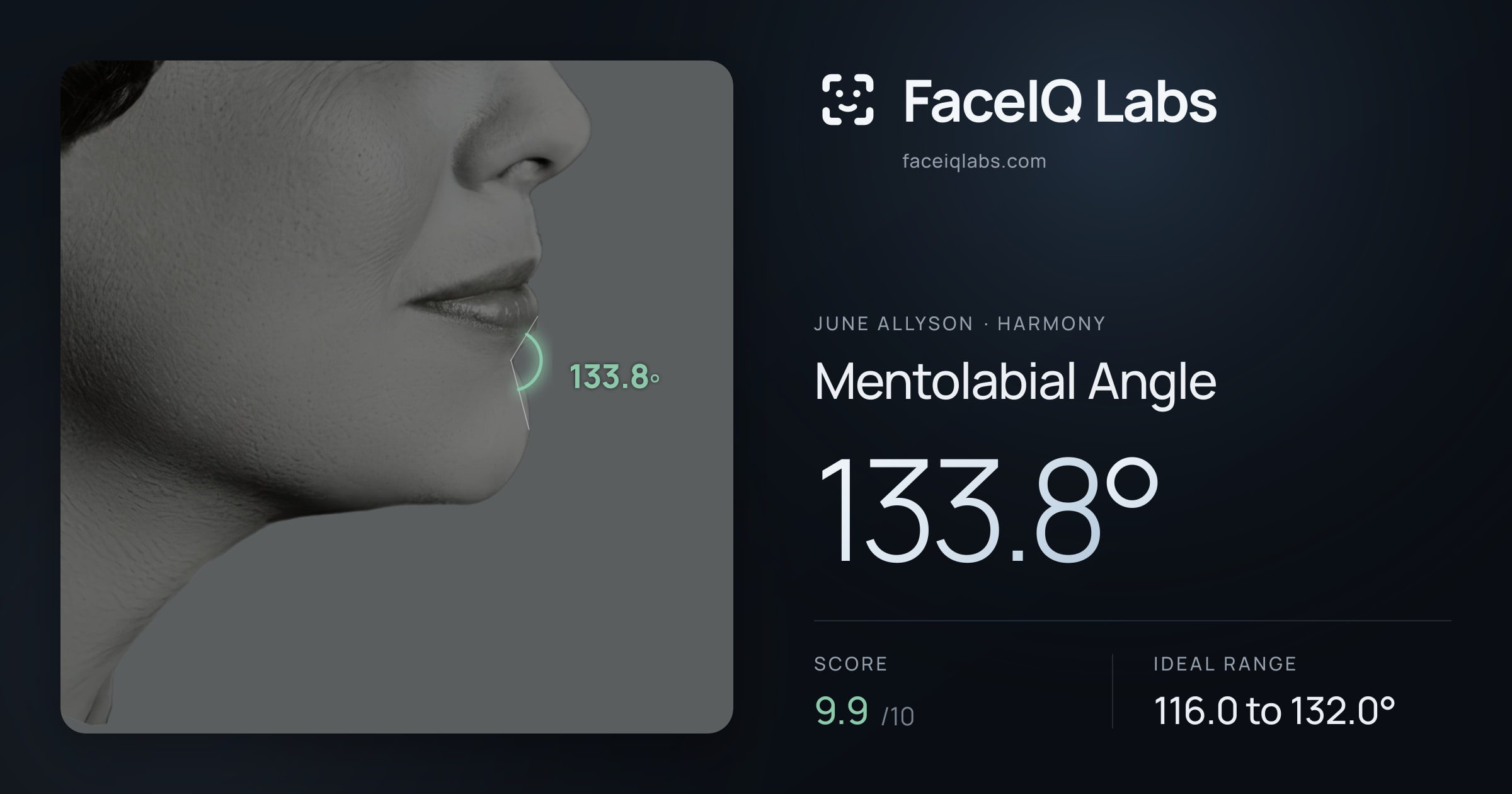 June Allyson Mentolabial Angle: 133.8°, drawn on the photo