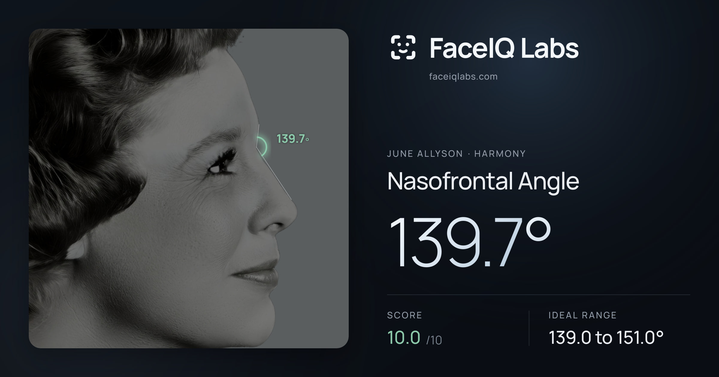 June Allyson Nasofrontal Angle: 139.7°, drawn on the photo