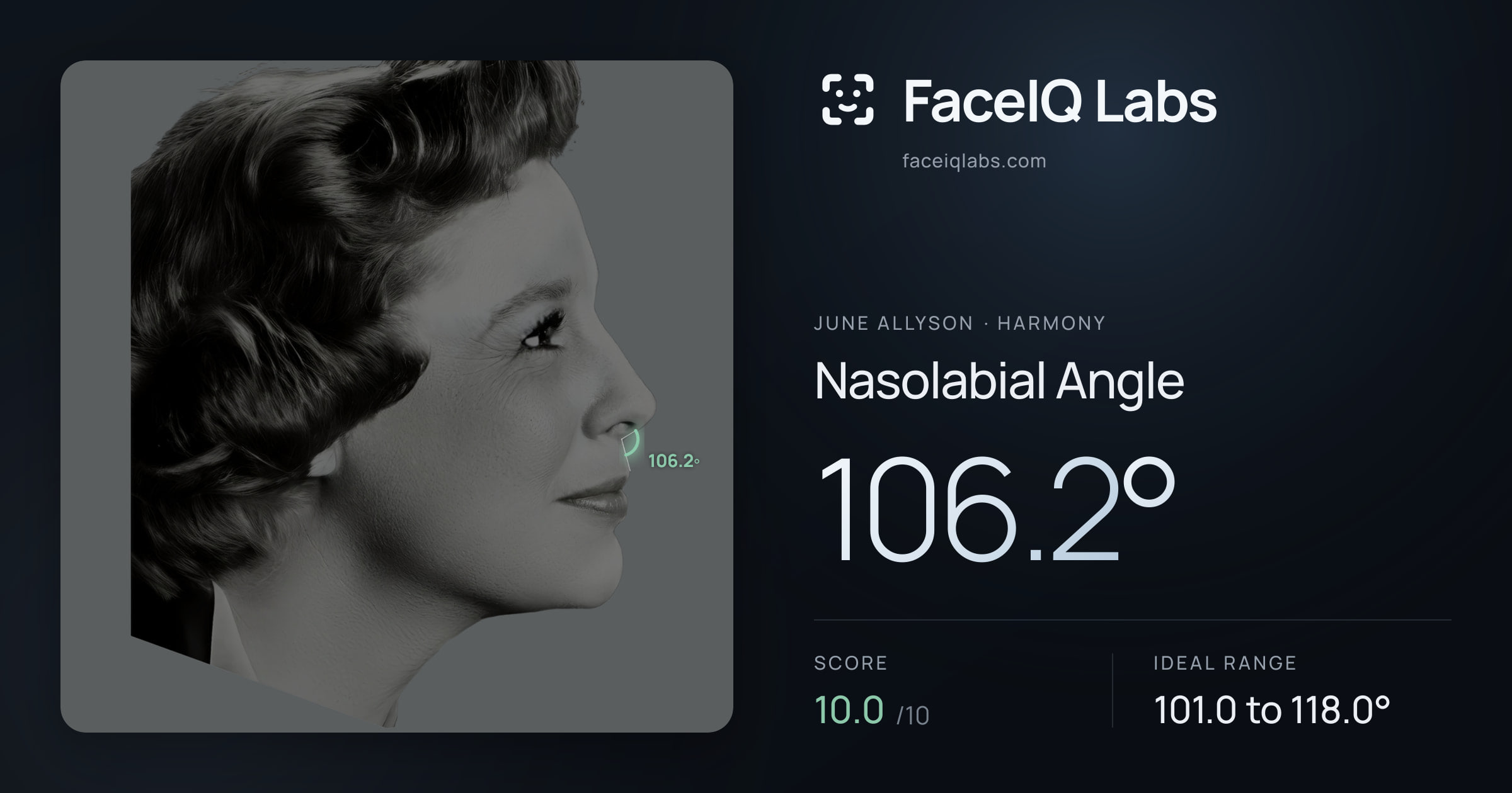 June Allyson Nasolabial Angle: 106.2°, drawn on the photo