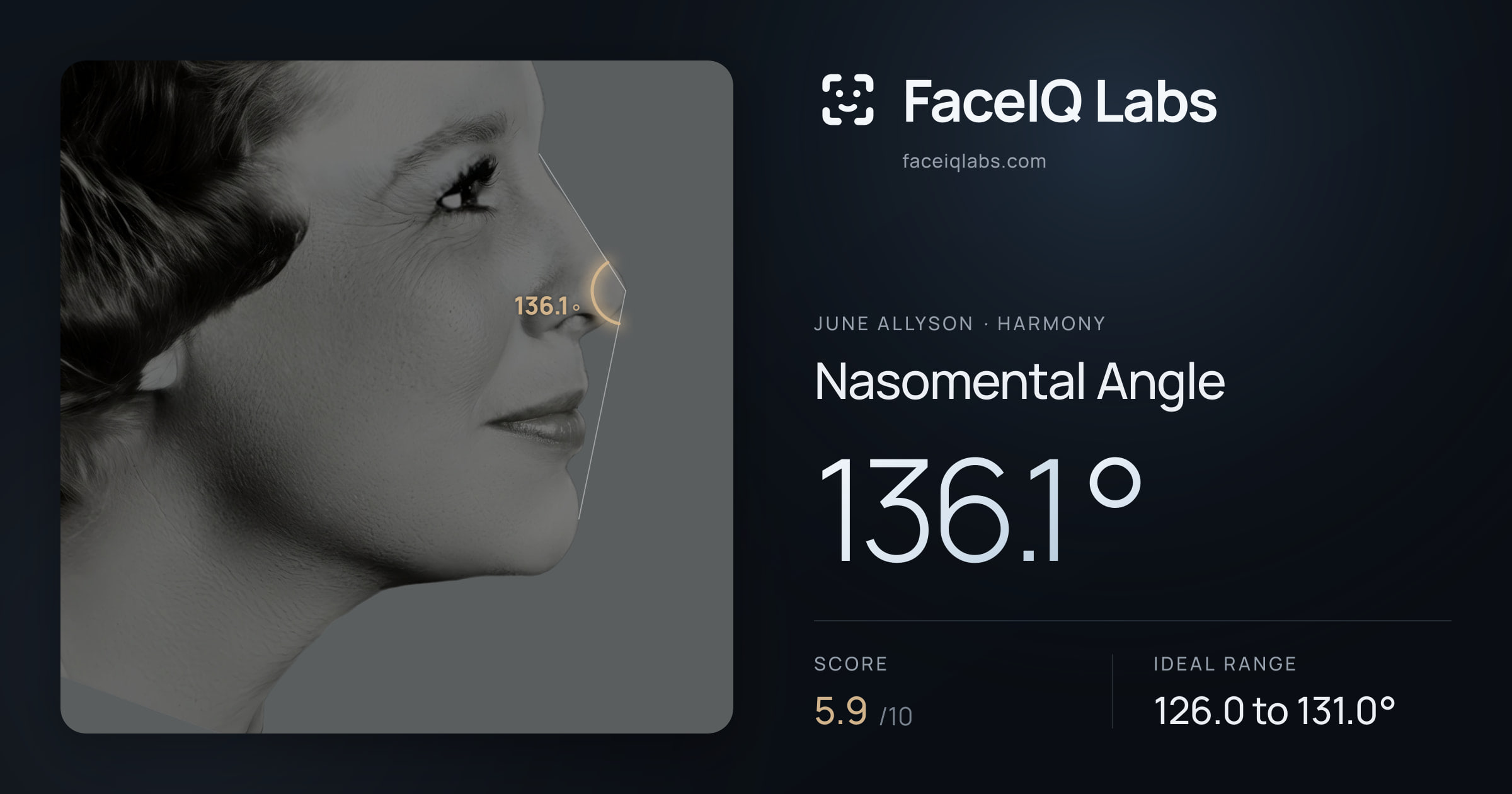 June Allyson Nasomental Angle: 136.1°, drawn on the photo