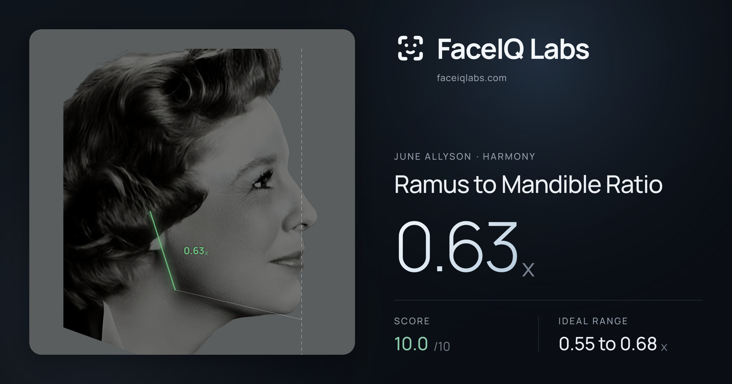 June Allyson Ramus to Mandible Ratio: 0.63x, drawn on the photo