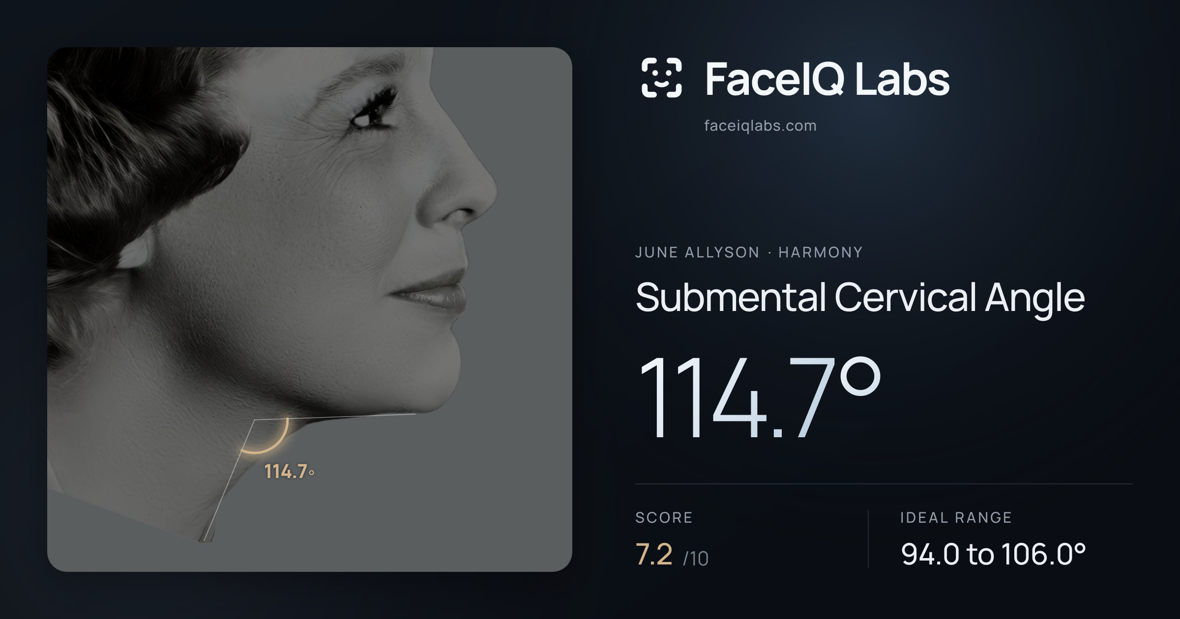 June Allyson Submental Cervical Angle: 114.7°, drawn on the photo