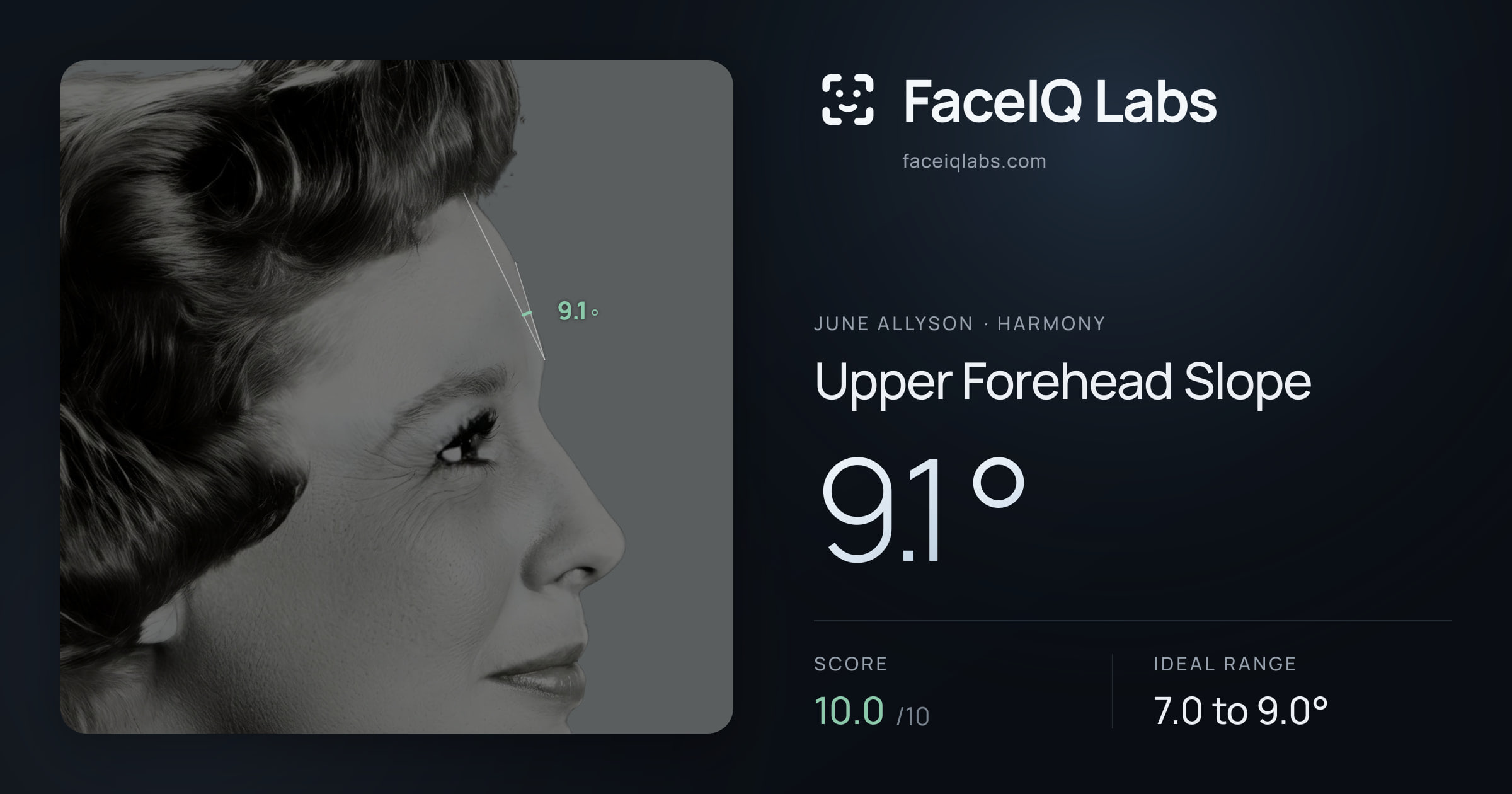 June Allyson Upper Forehead Slope: 9.1°, drawn on the photo
