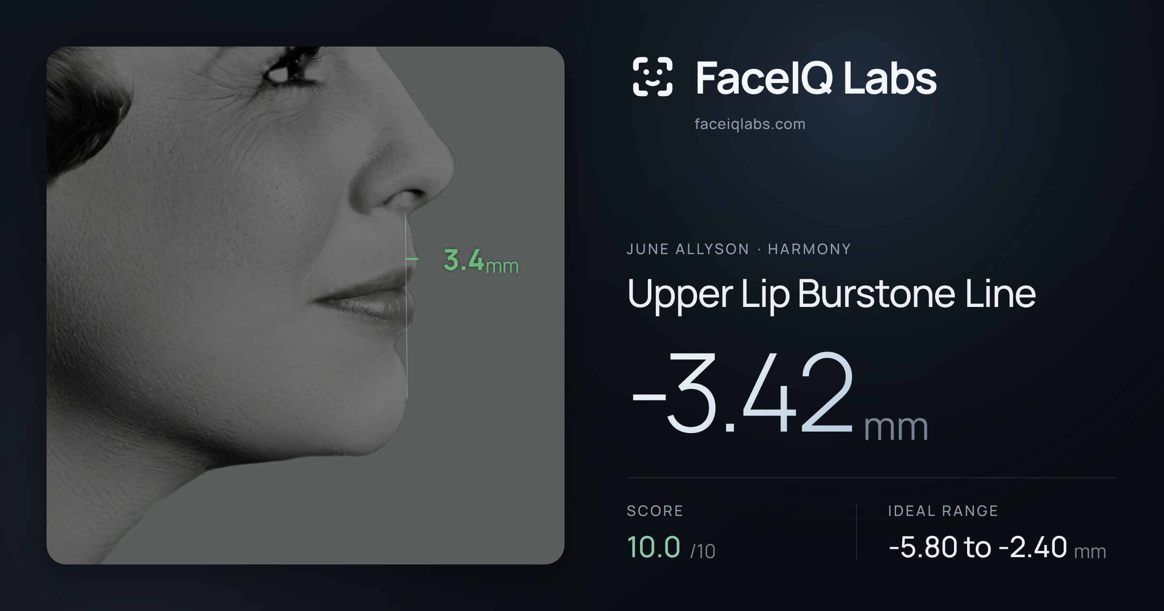 June Allyson Upper Lip Burstone Line: -3.42mm, drawn on the photo