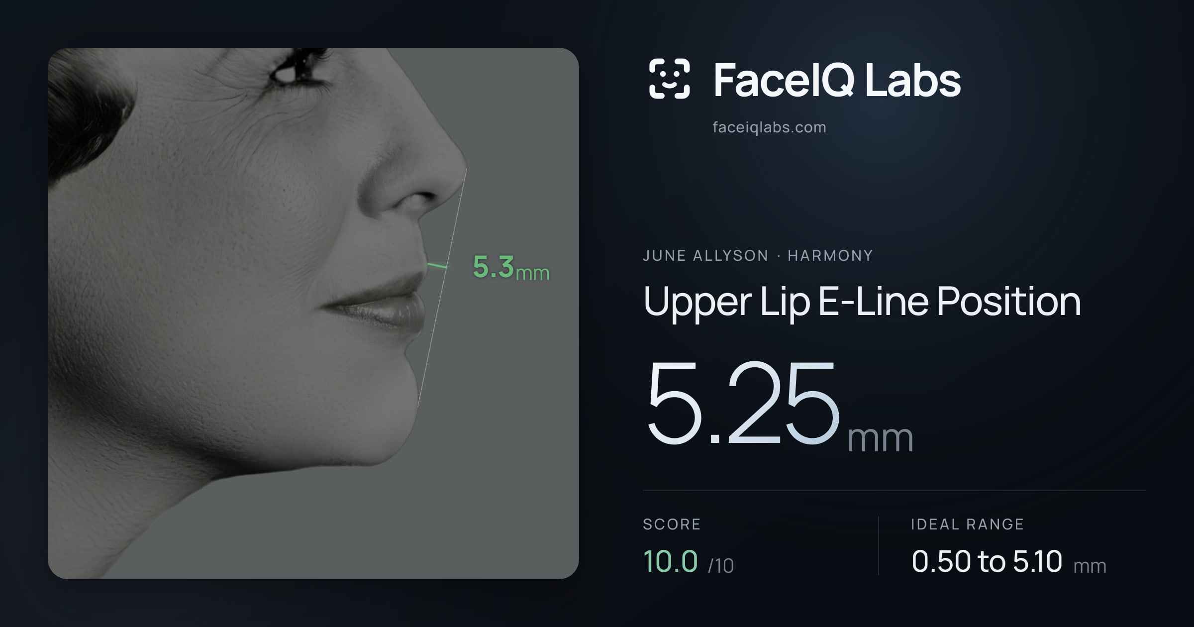 June Allyson Upper Lip E-Line Position: 5.25mm, drawn on the photo