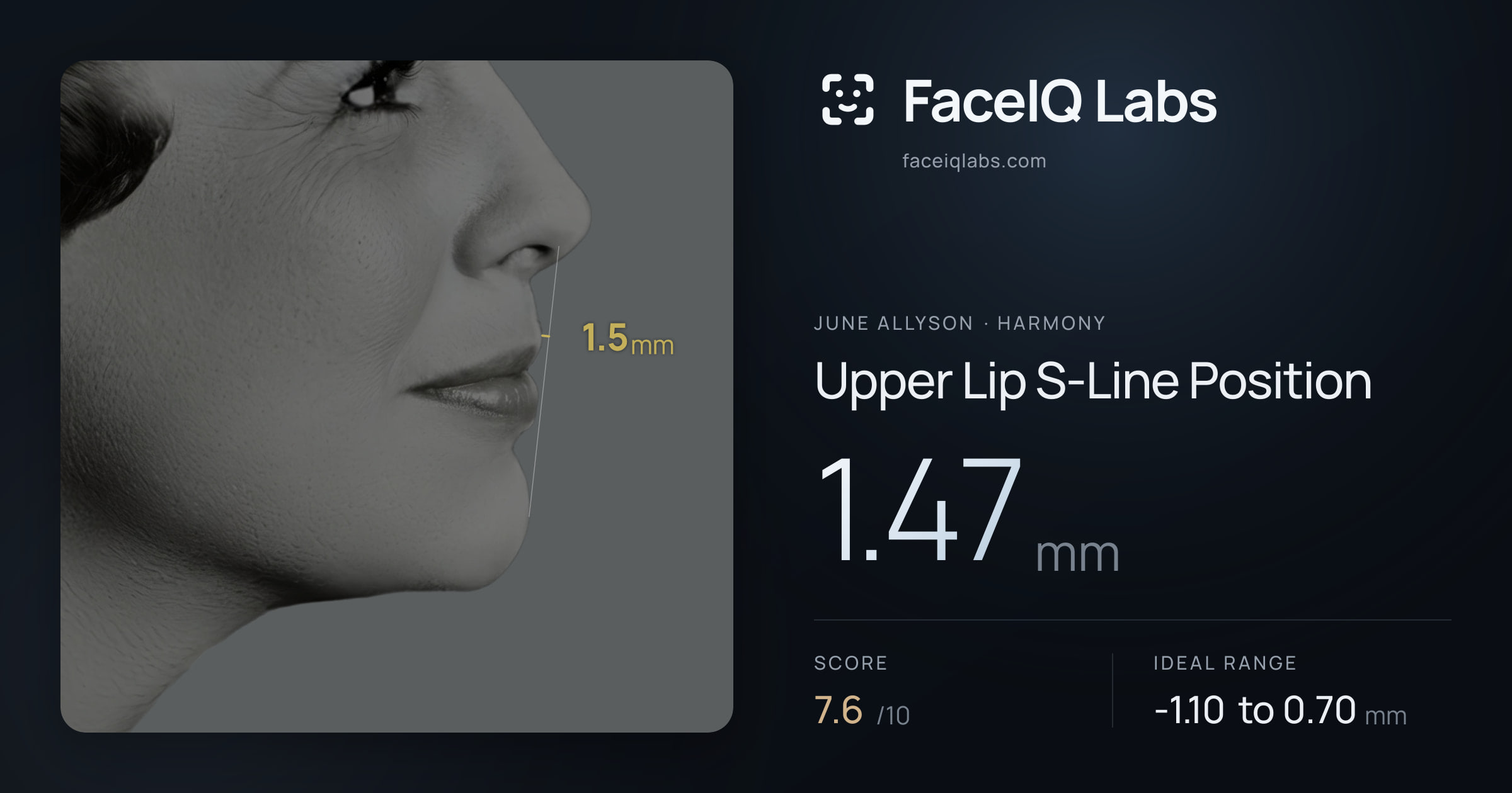 June Allyson Upper Lip S-Line Position: 1.47mm, drawn on the photo
