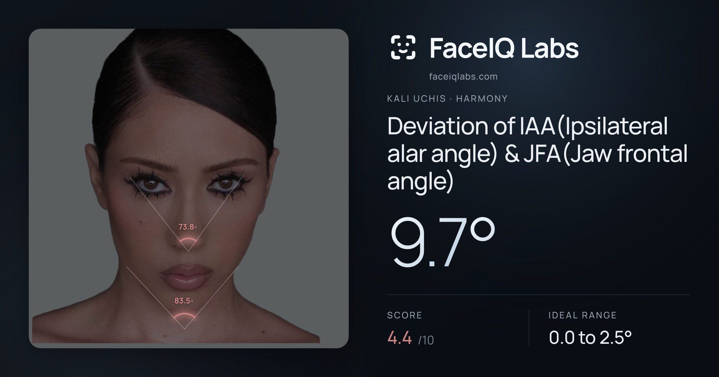 Kali Uchis Deviation of IAA(Ipsilateral alar angle) & JFA(Jaw frontal angle): 9.7°, drawn on the photo