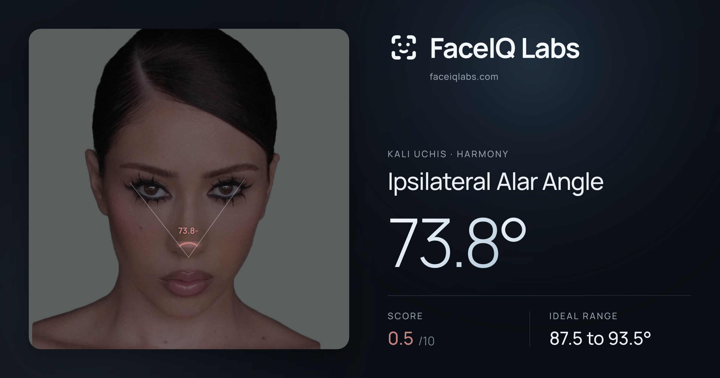 Kali Uchis Ipsilateral Alar Angle: 73.8°, drawn on the photo