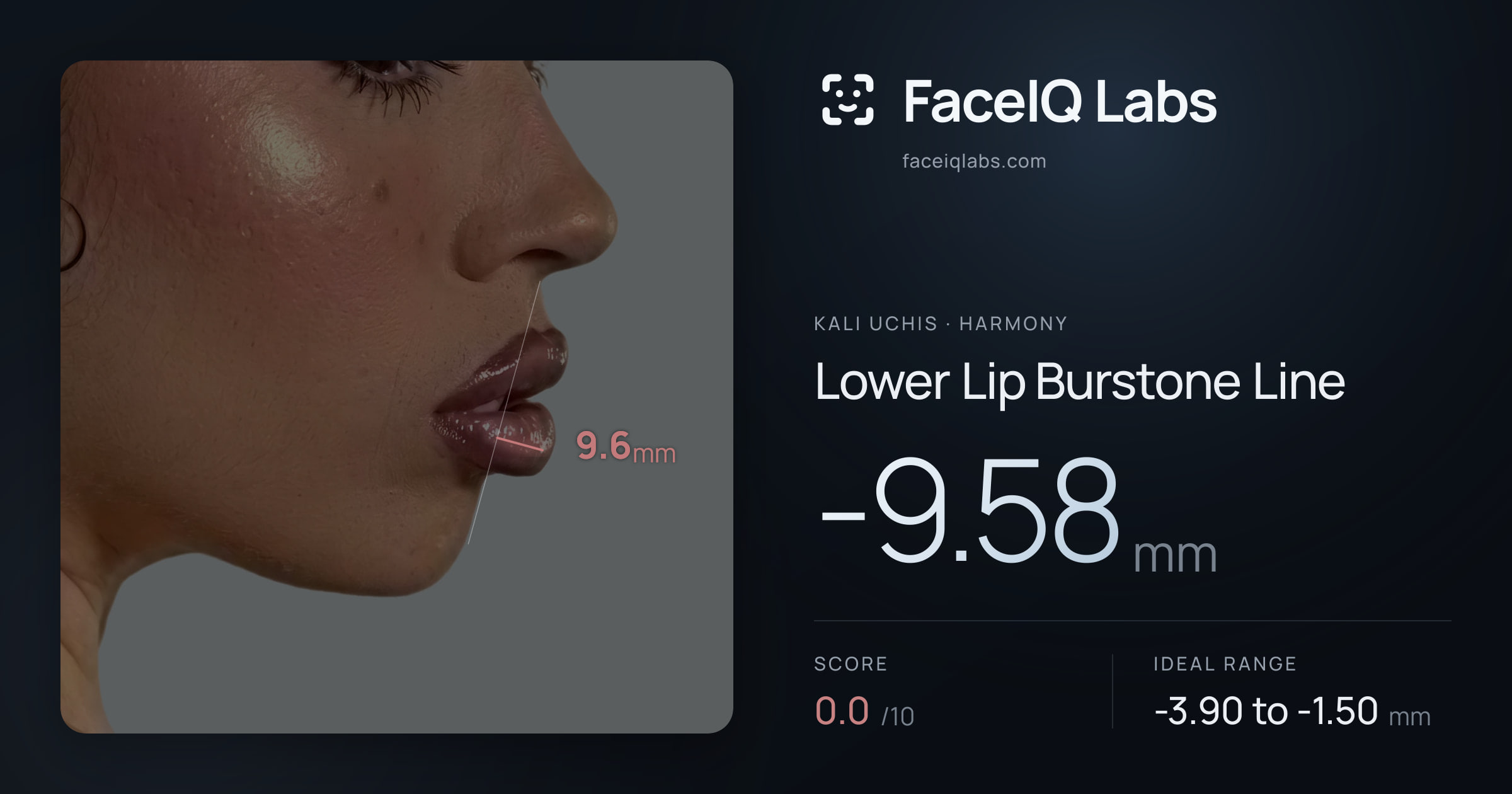 Kali Uchis Lower Lip Burstone Line: -9.58mm, drawn on the photo