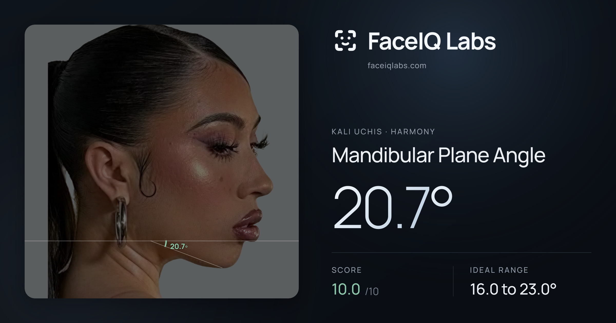 Kali Uchis Mandibular Plane Angle: 20.7°, drawn on the photo