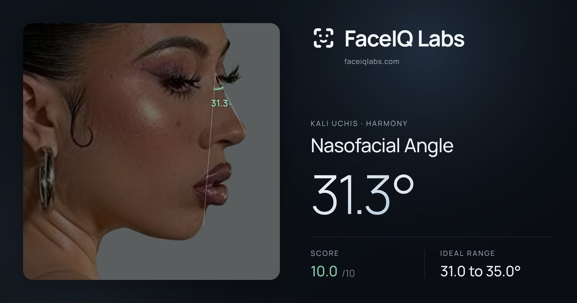 Kali Uchis Nasofacial Angle: 31.3°, drawn on the photo