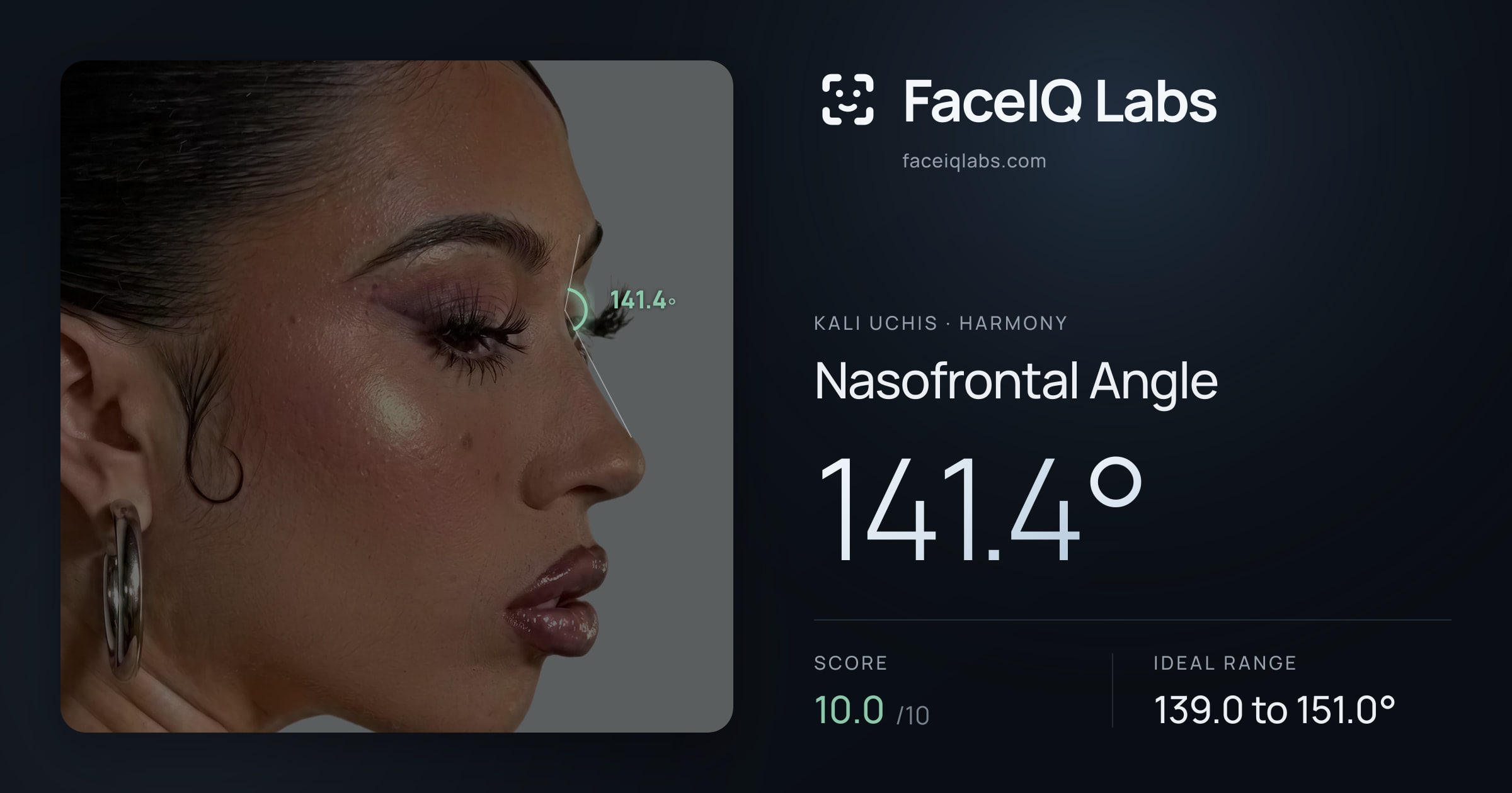Kali Uchis Nasofrontal Angle: 141.4°, drawn on the photo
