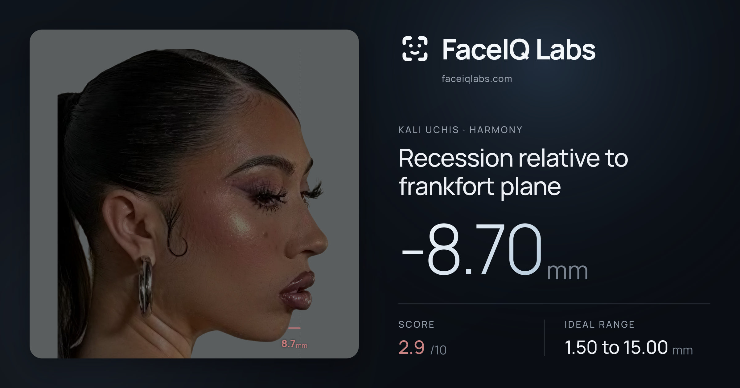 Kali Uchis Recession relative to frankfort plane: -8.70mm, drawn on the photo