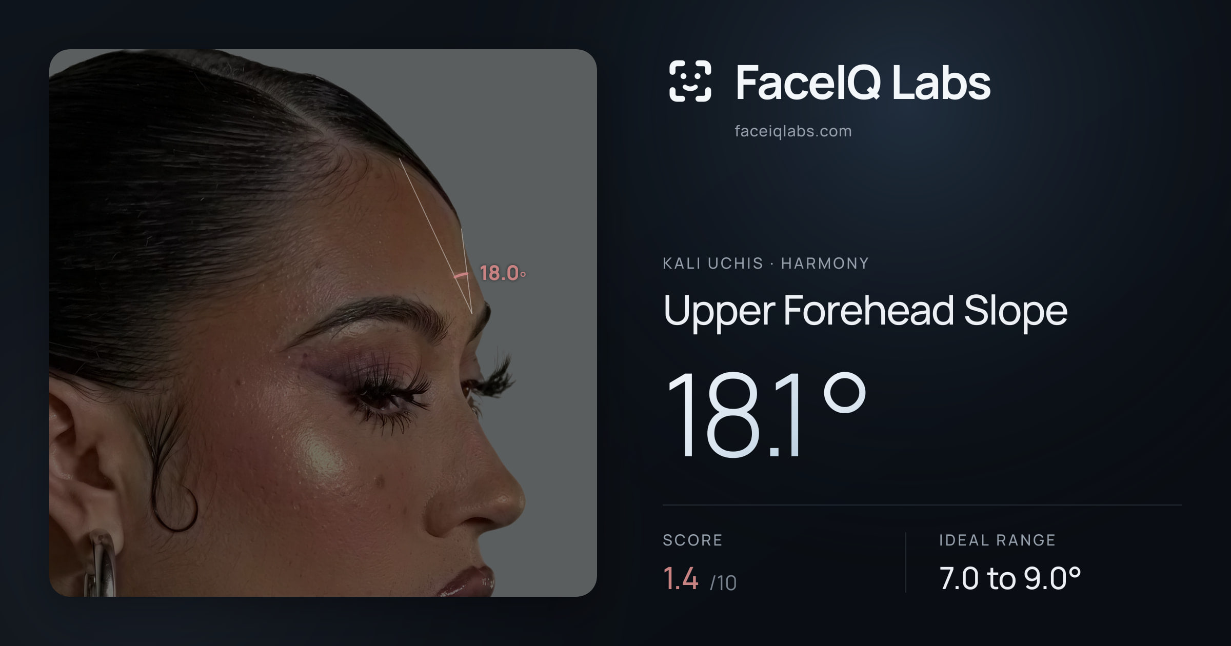 Kali Uchis Upper Forehead Slope: 18.1°, drawn on the photo