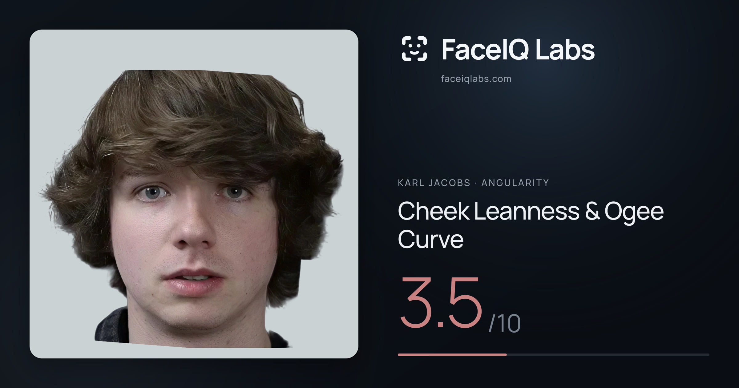 Karl Jacobs Cheek Leanness & Ogee Curve: 3.5/10, drawn on the photo