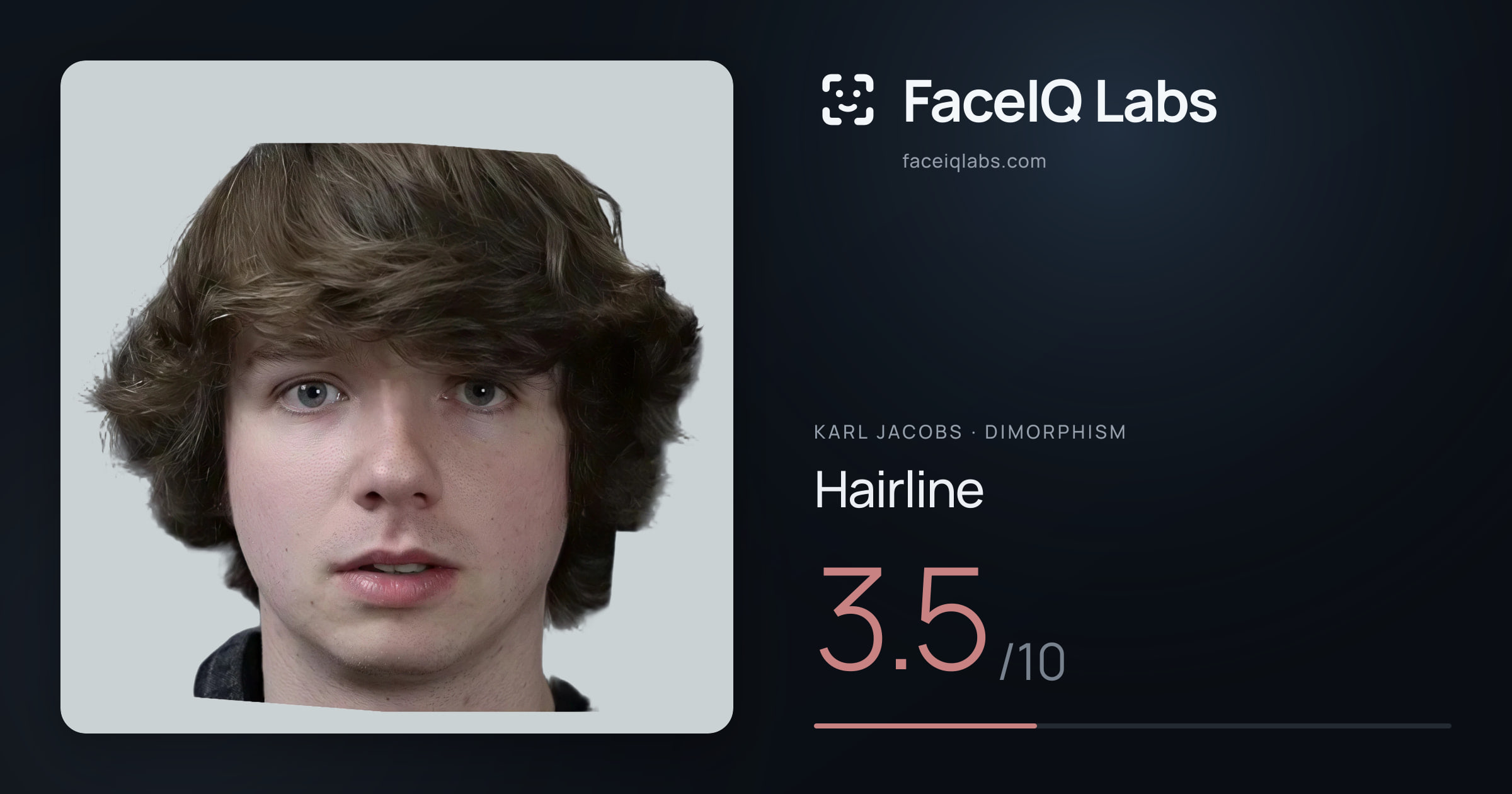 Karl Jacobs Hairline: 3.5/10, drawn on the photo