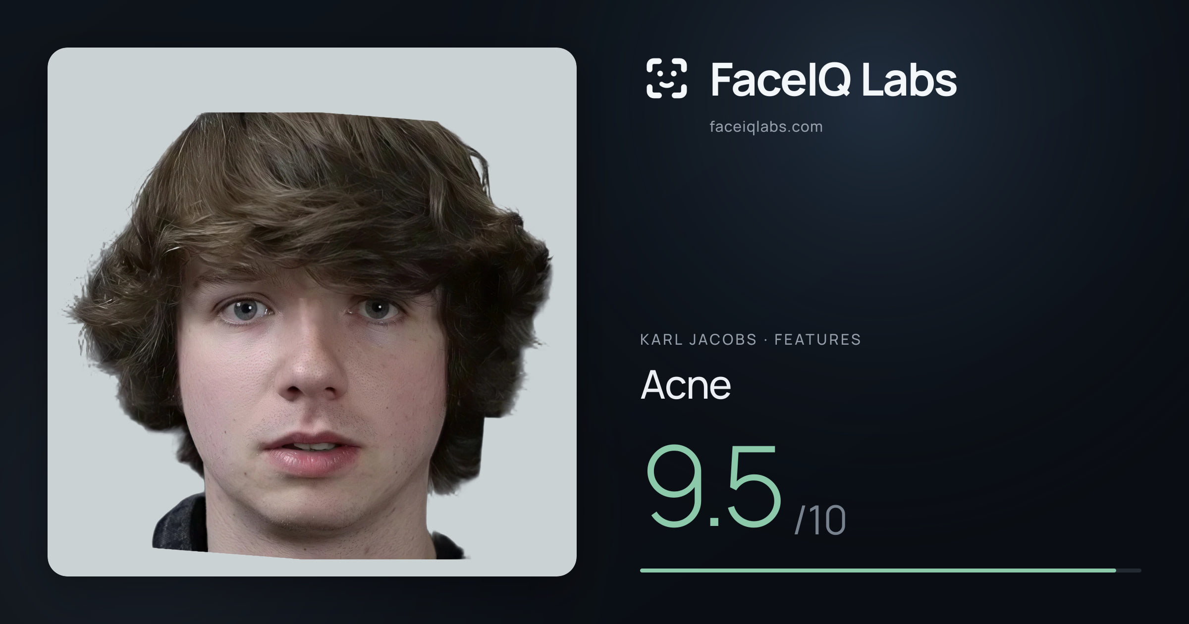 Karl Jacobs Acne: 9.5/10, drawn on the photo