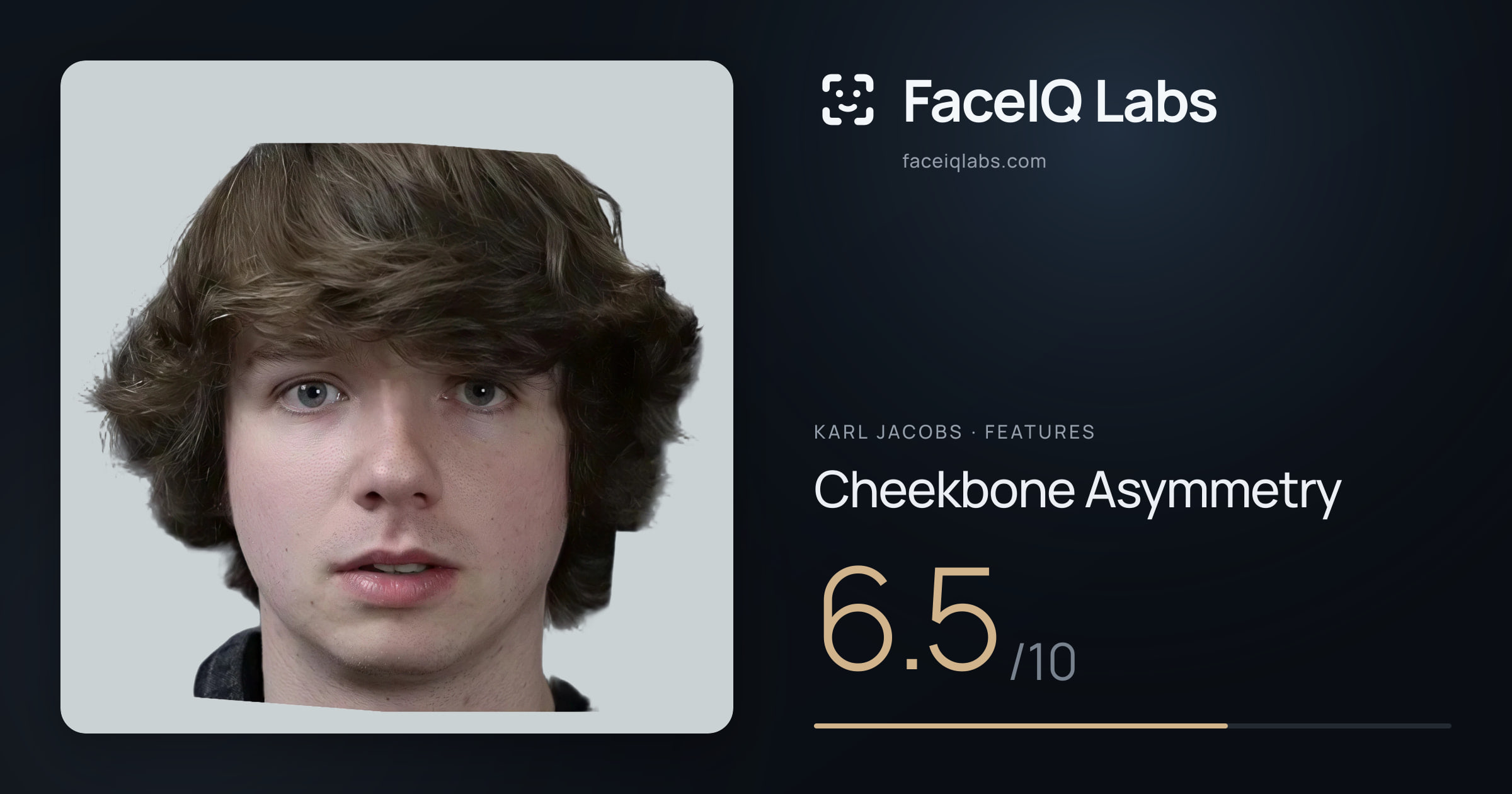 Karl Jacobs Cheekbone Asymmetry: 6.5/10, drawn on the photo