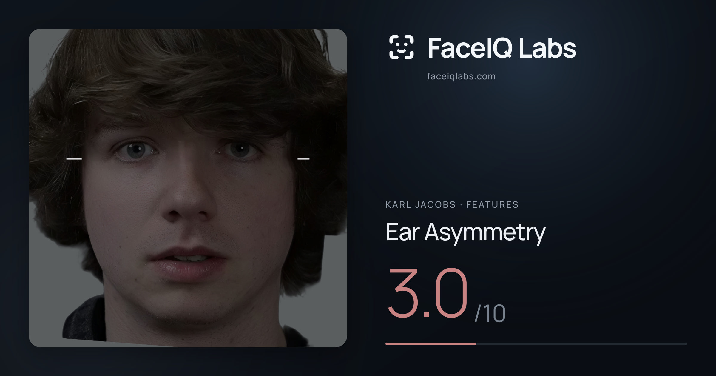Karl Jacobs Ear Asymmetry: 3.0/10, drawn on the photo
