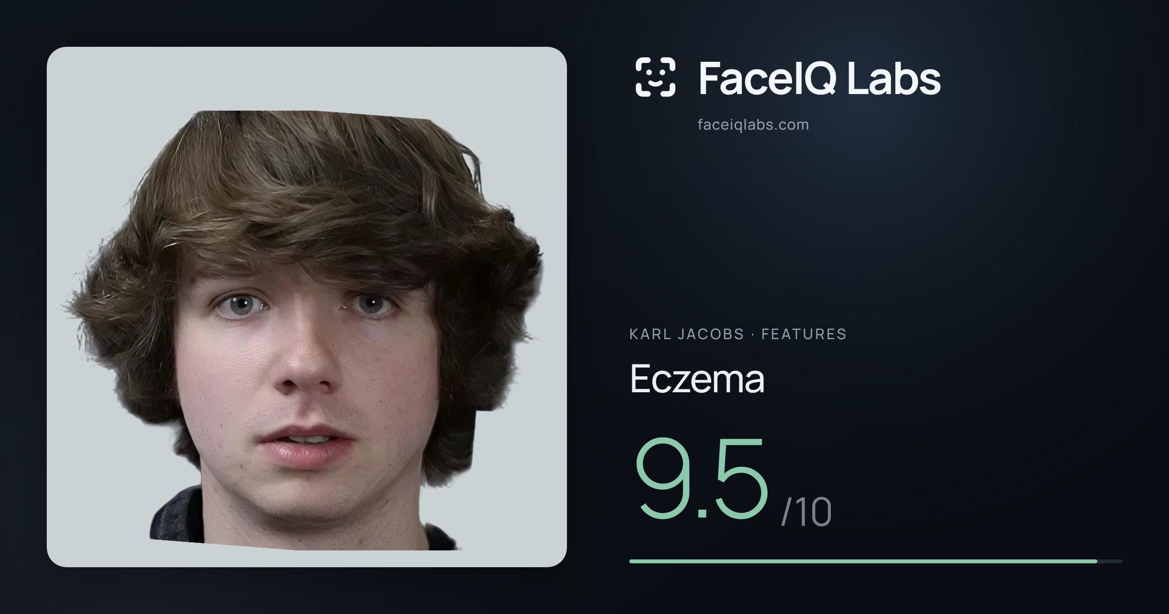 Karl Jacobs Eczema: 9.5/10, drawn on the photo