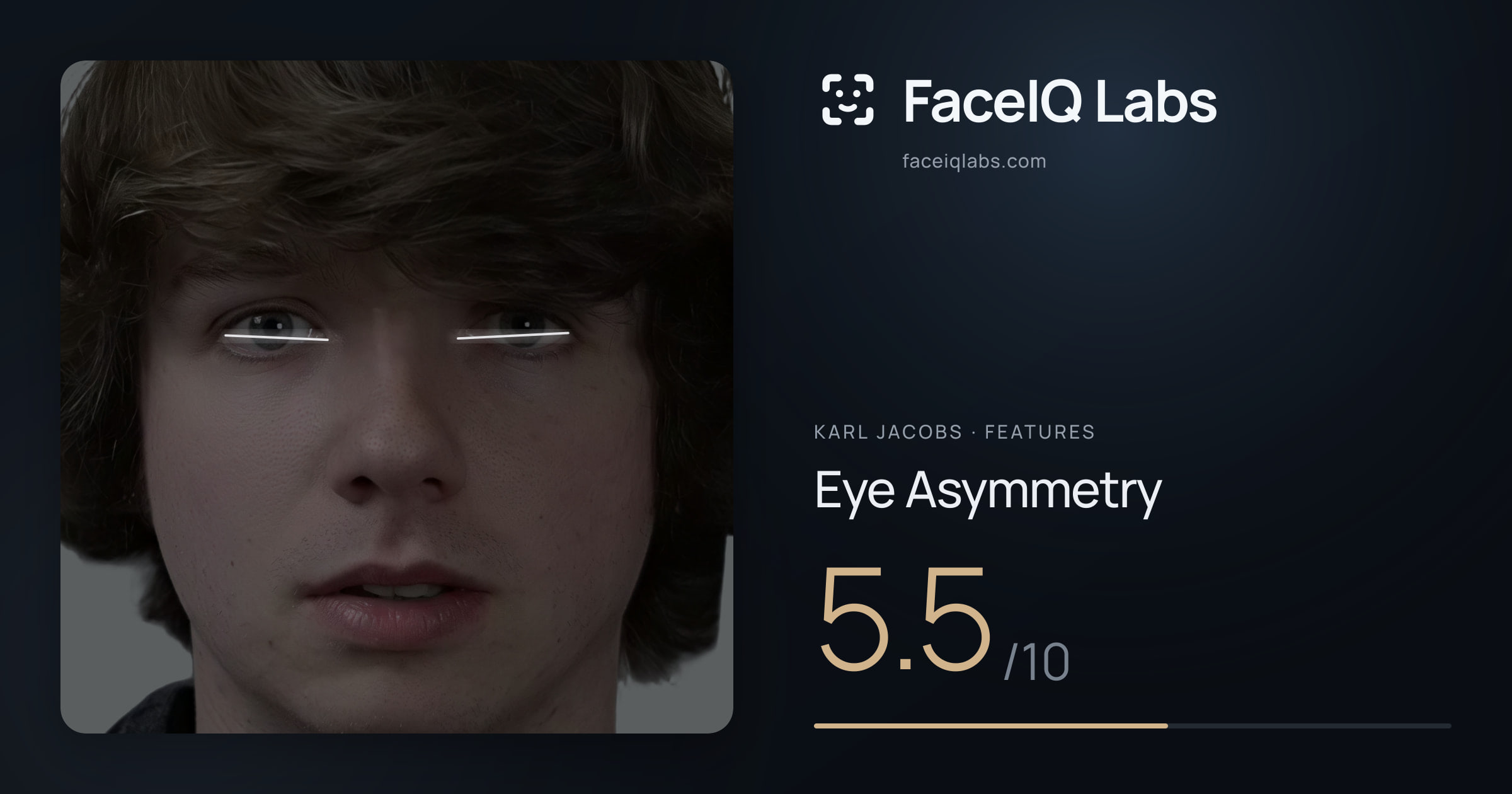 Karl Jacobs Eye Asymmetry: 5.5/10, drawn on the photo