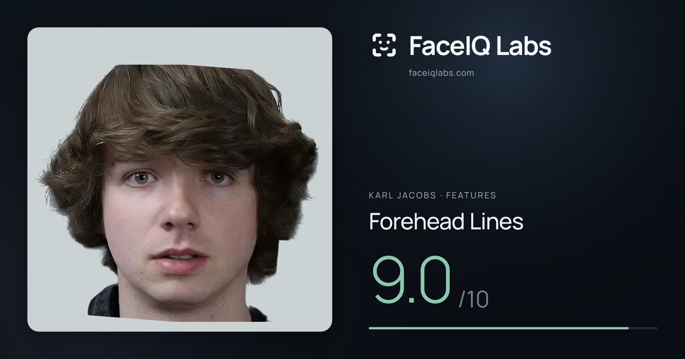 Karl Jacobs Forehead Lines: 9.0/10, drawn on the photo