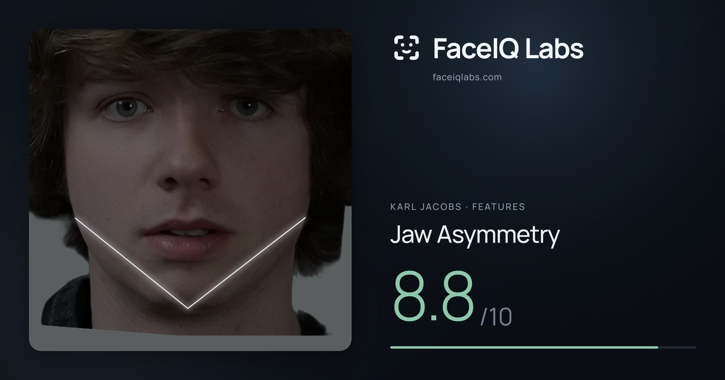 Karl Jacobs Jaw Asymmetry: 8.8/10, drawn on the photo