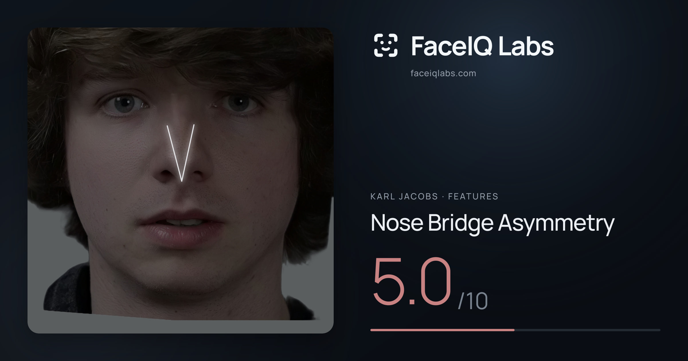 Karl Jacobs Nose Bridge Asymmetry: 5.0/10, drawn on the photo