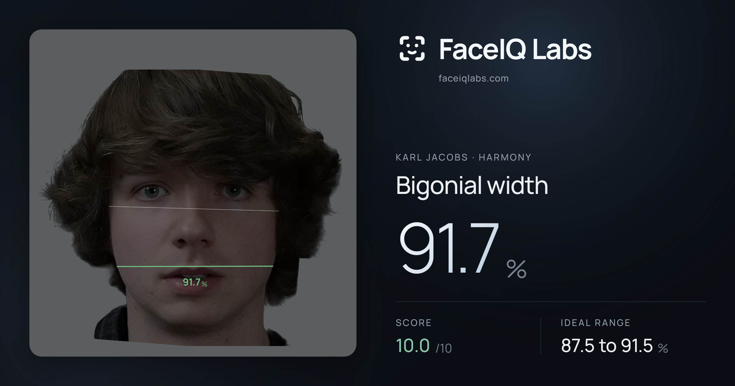 Karl Jacobs Bigonial width: 91.7%, drawn on the photo