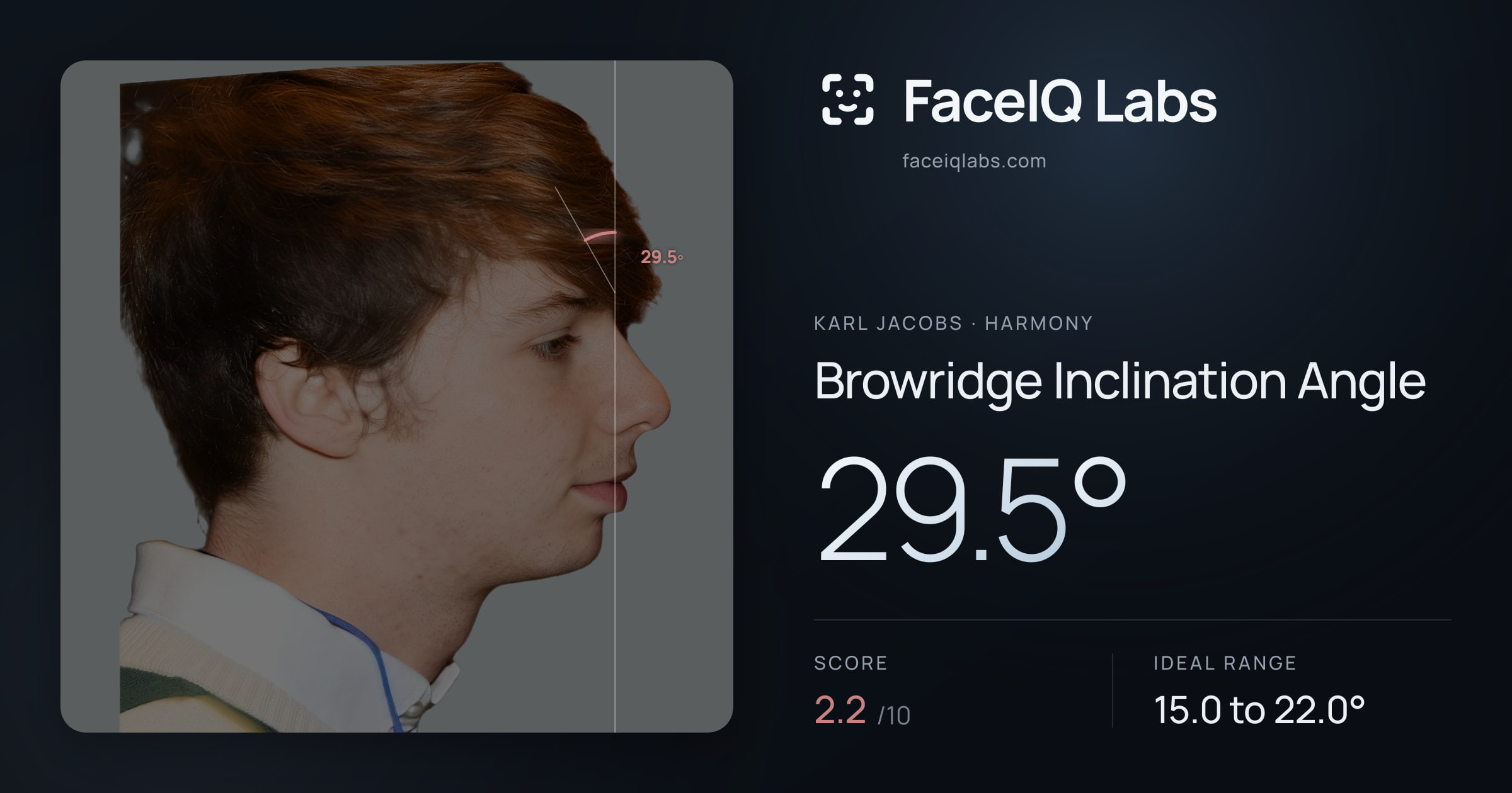 Karl Jacobs Browridge Inclination Angle: 29.5°, drawn on the photo