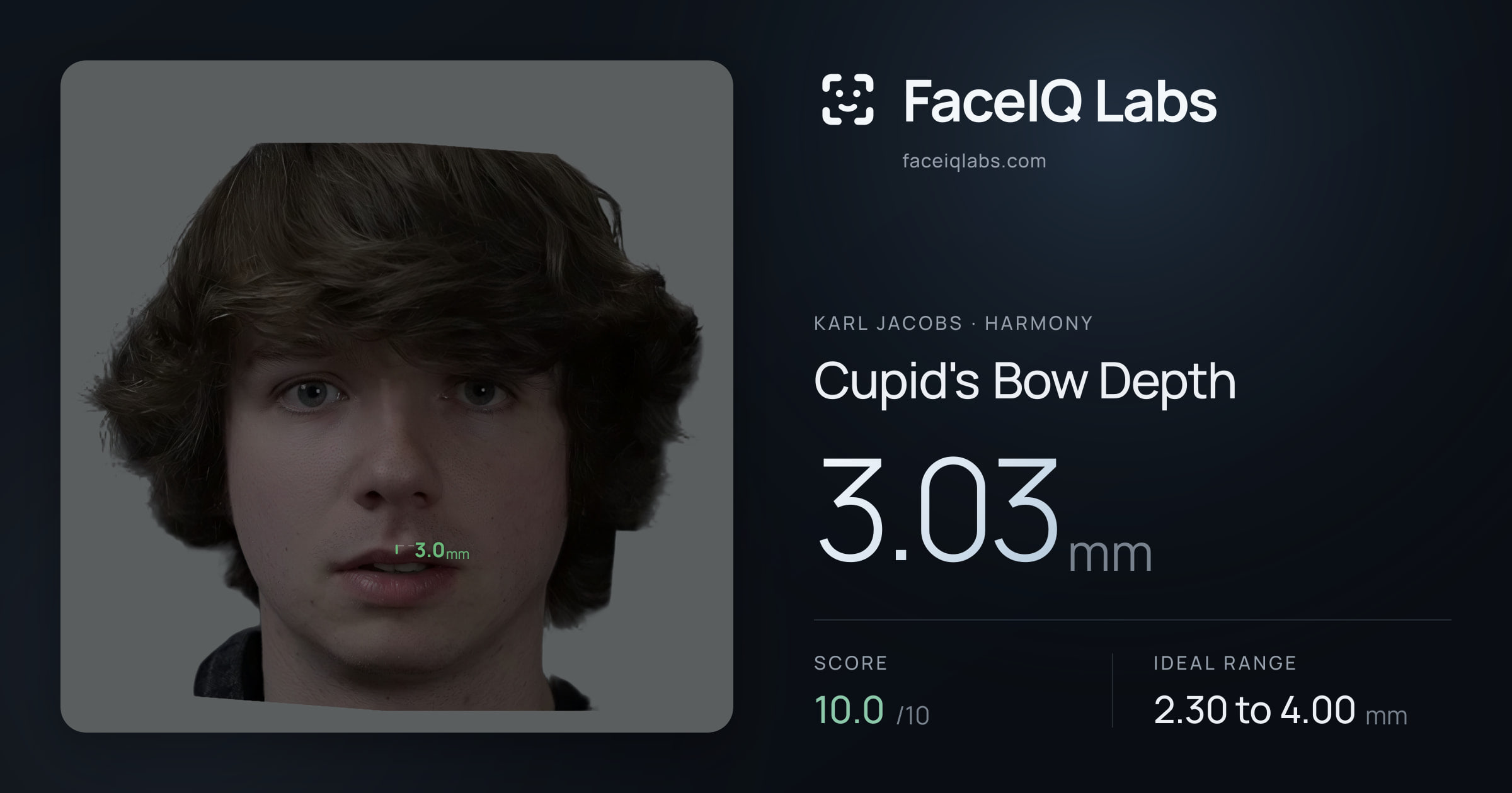 Karl Jacobs Cupid's Bow Depth: 3.03mm, drawn on the photo