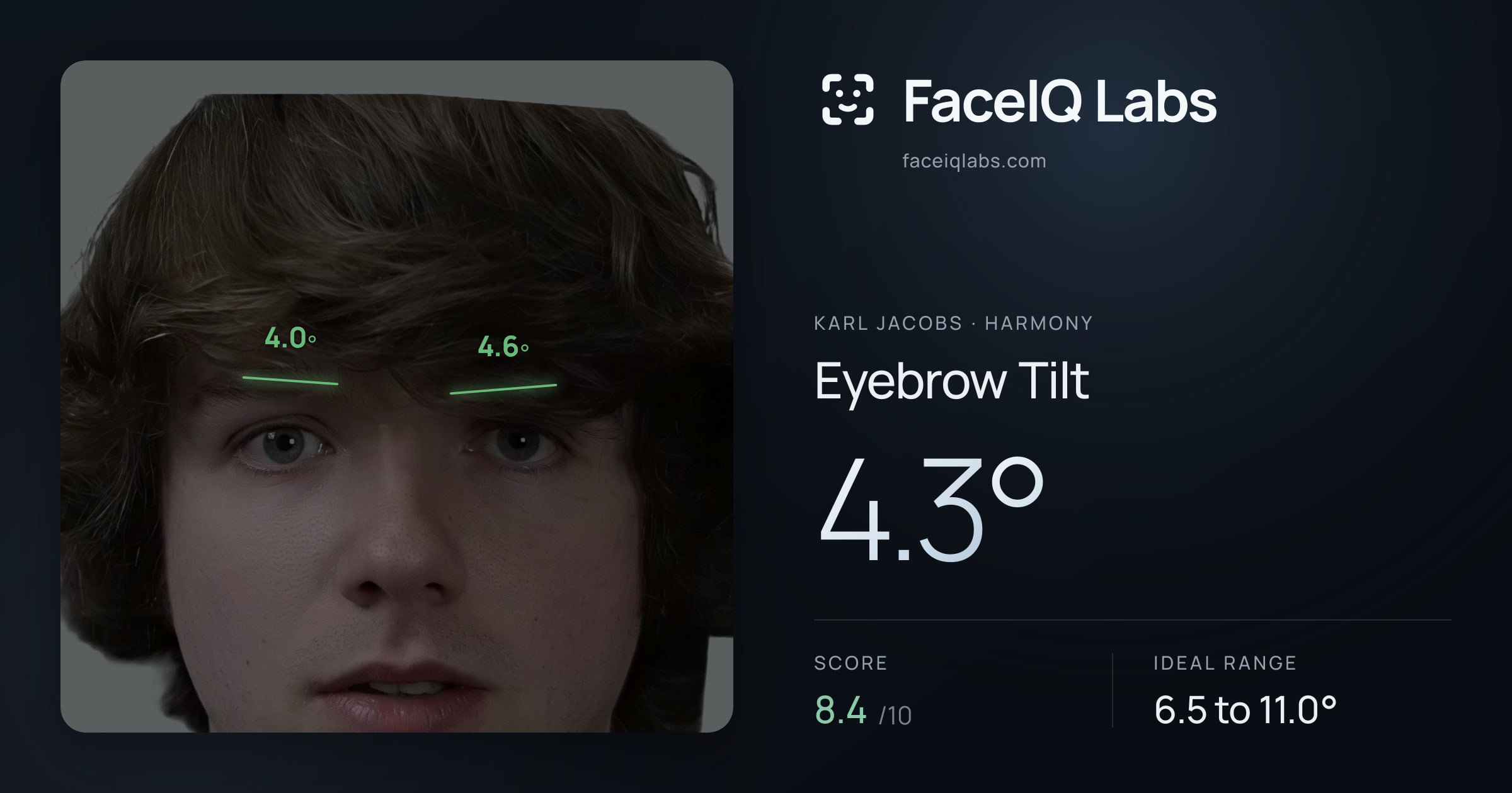 Karl Jacobs Eyebrow Tilt: 4.3°, drawn on the photo