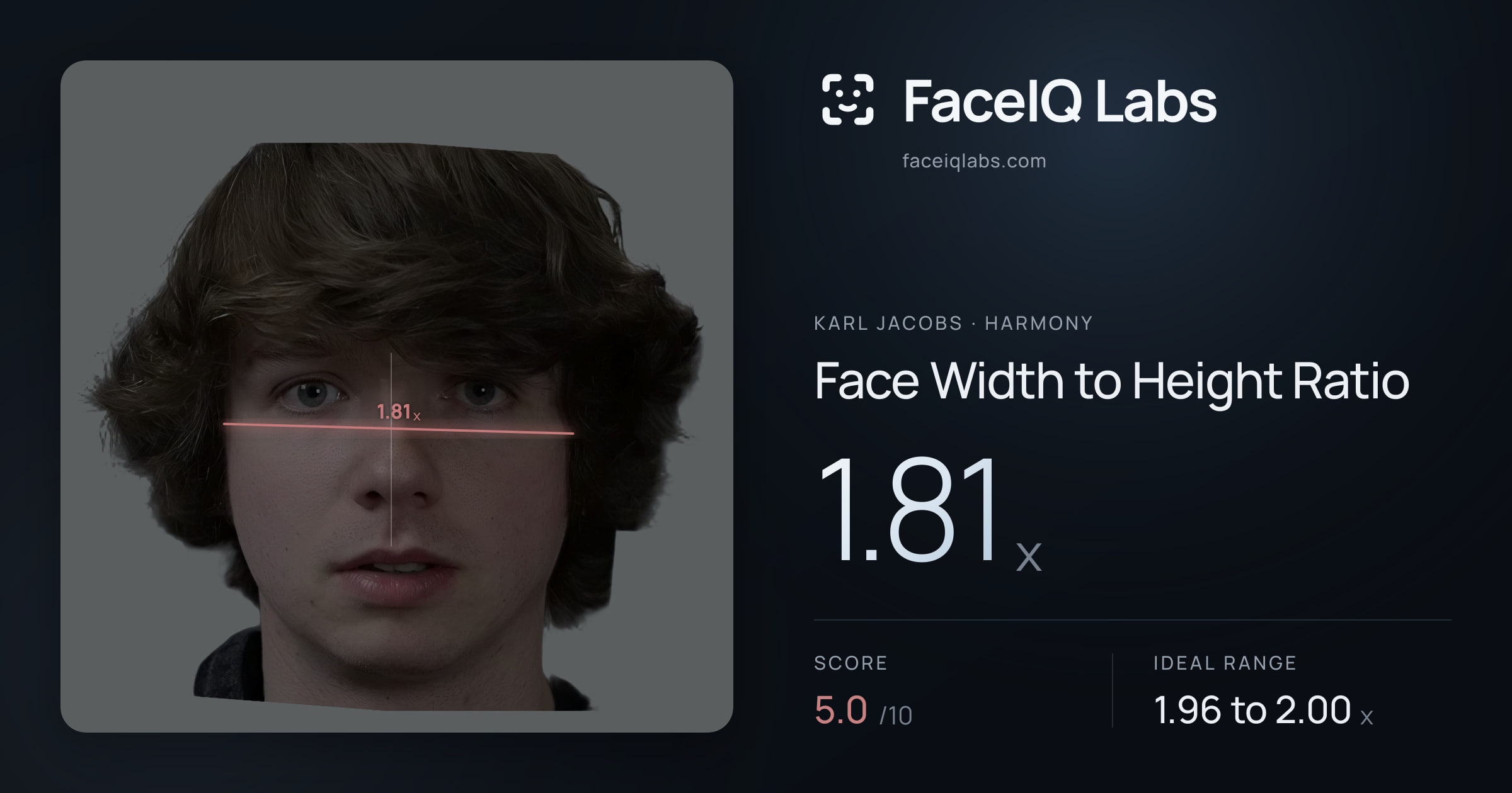 Karl Jacobs Face Width to Height Ratio: 1.81x, drawn on the photo