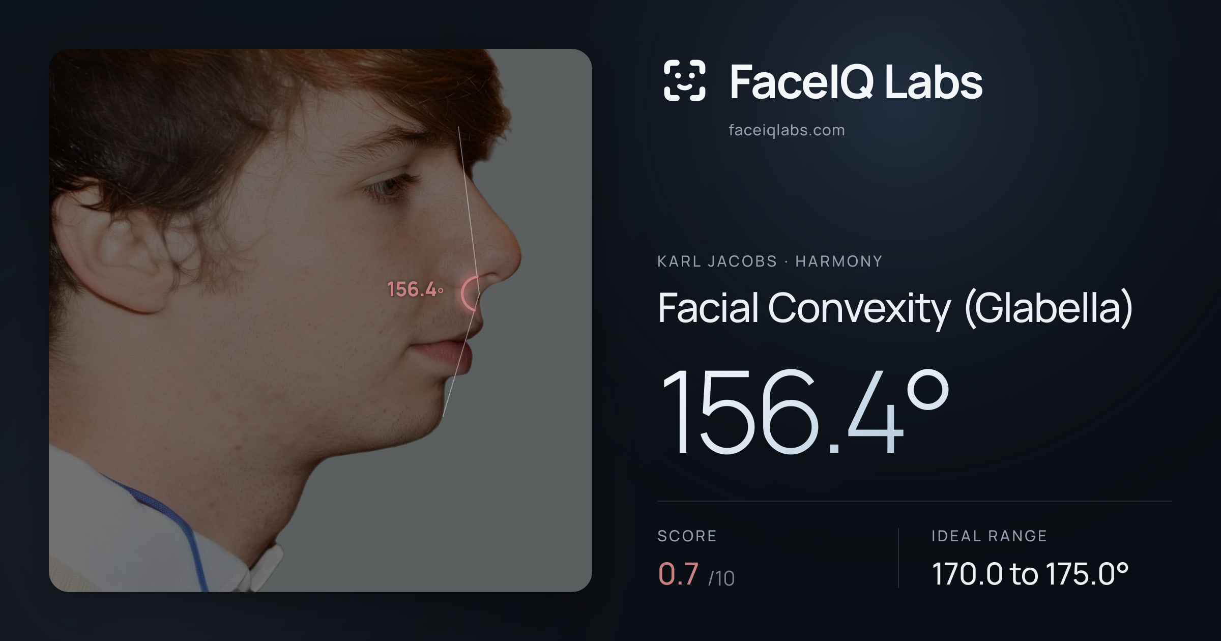 Karl Jacobs Facial Convexity (Glabella): 156.4°, drawn on the photo