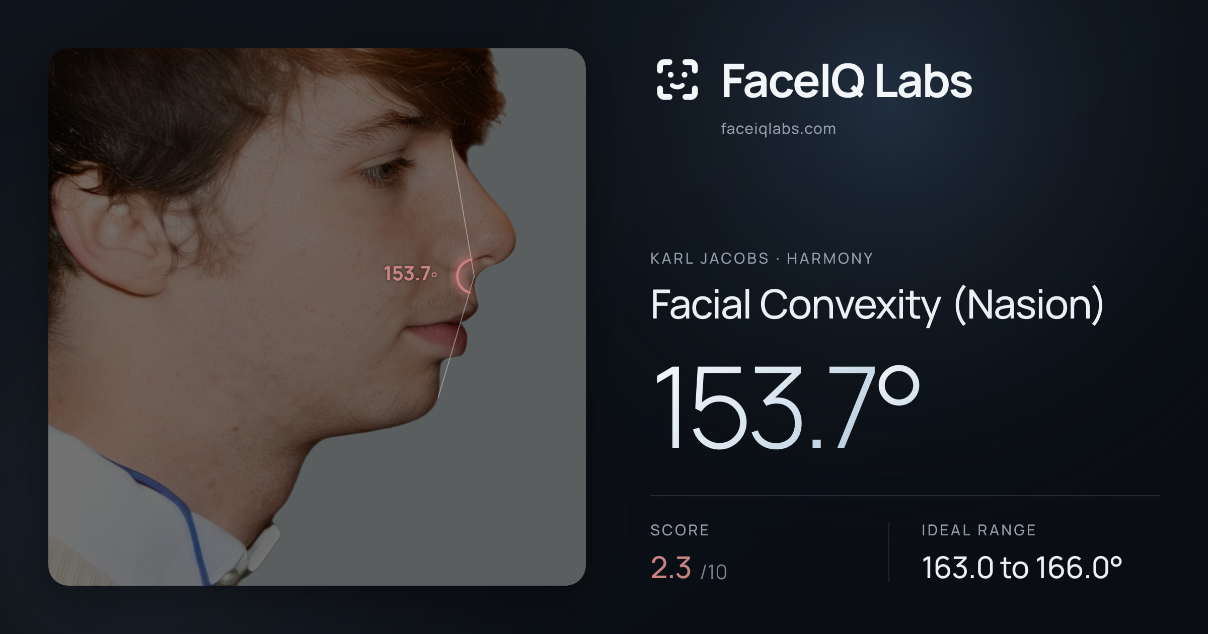 Karl Jacobs Facial Convexity (Nasion): 153.7°, drawn on the photo