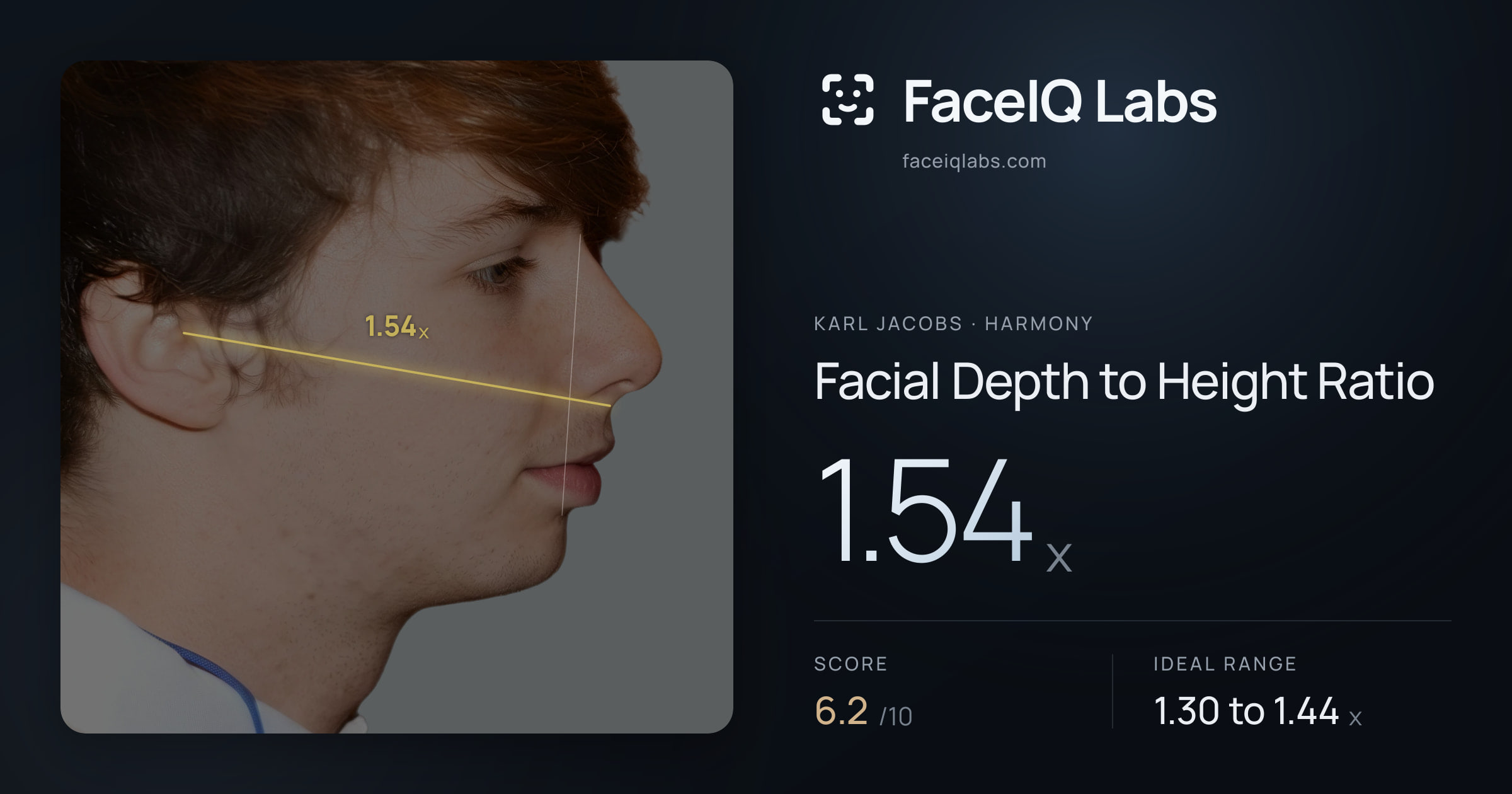 Karl Jacobs Facial Depth to Height Ratio: 1.54x, drawn on the photo