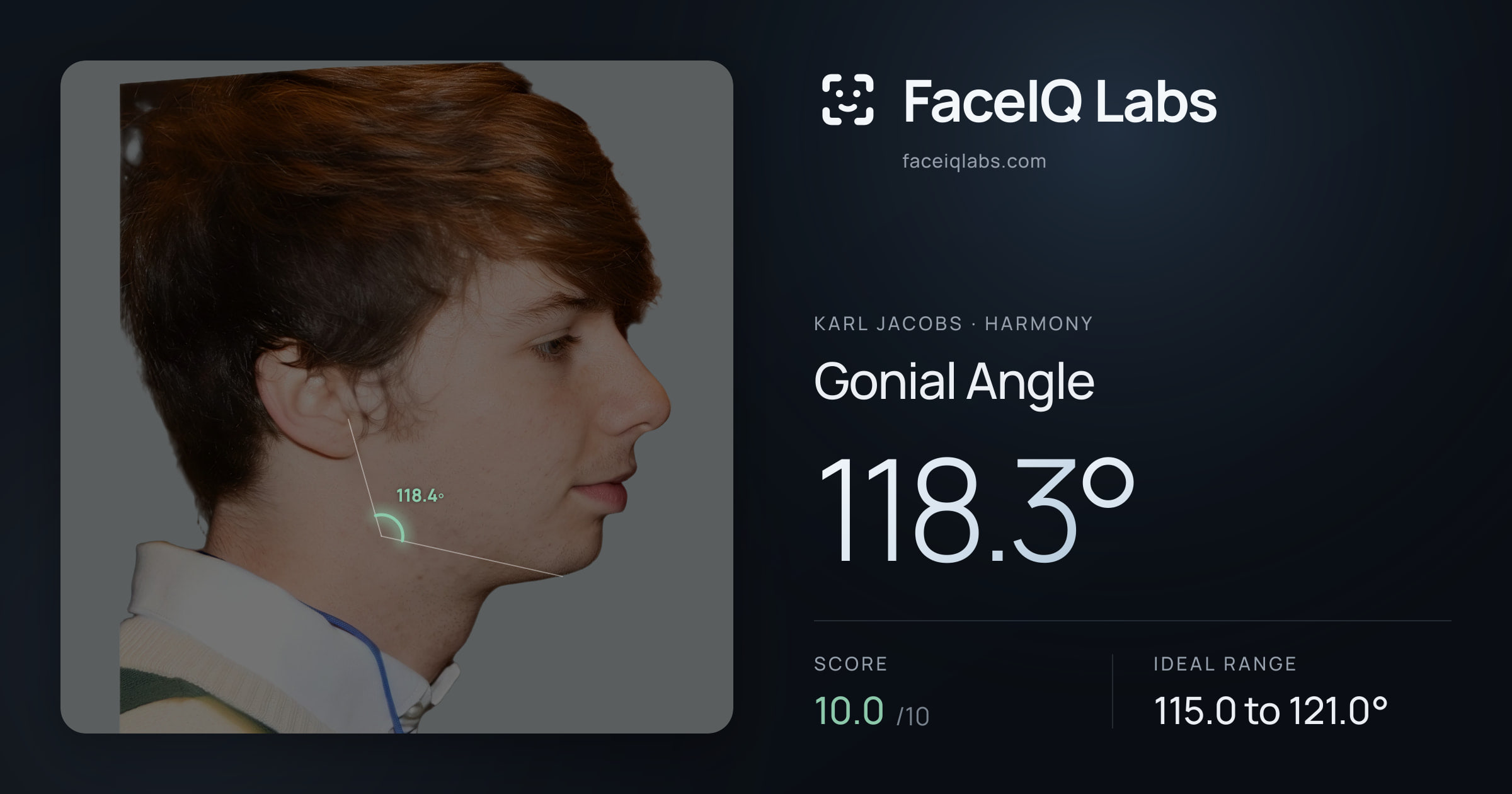 Karl Jacobs Gonial Angle: 118.3°, drawn on the photo