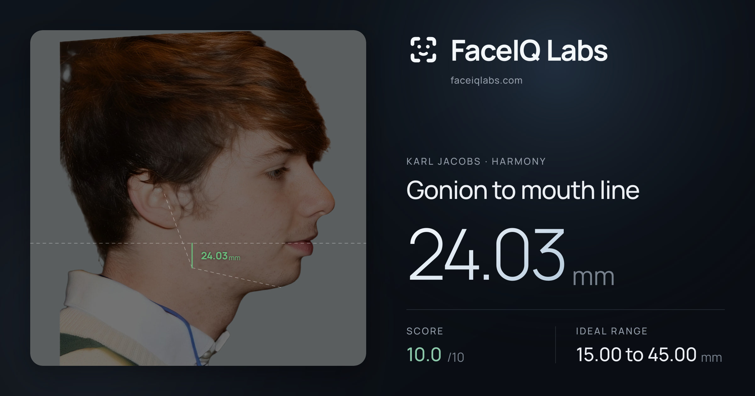 Karl Jacobs Gonion to mouth line: 24.03mm, drawn on the photo