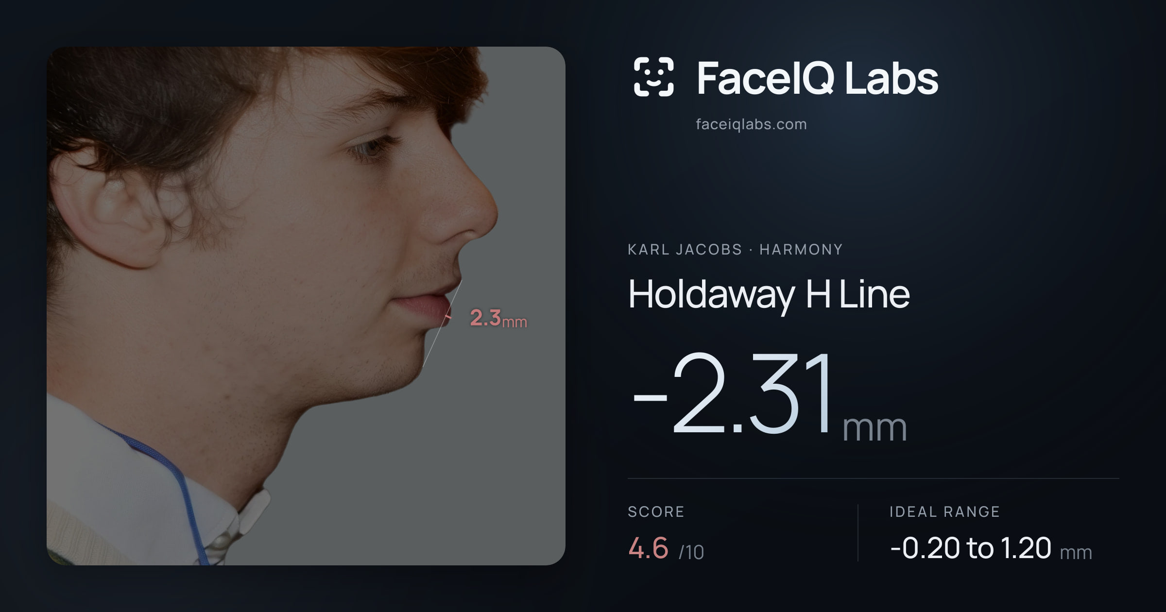 Karl Jacobs Holdaway H Line: -2.31mm, drawn on the photo