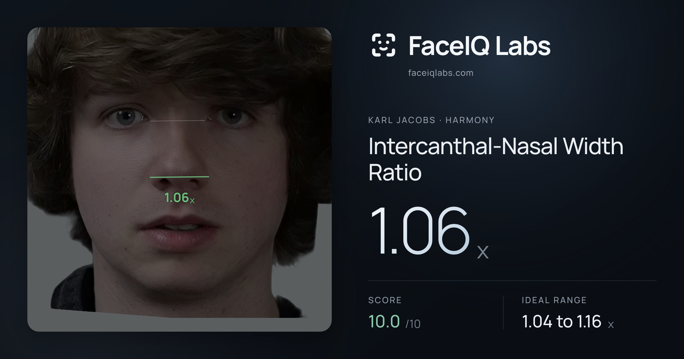 Karl Jacobs Intercanthal-Nasal Width Ratio: 1.06x, drawn on the photo