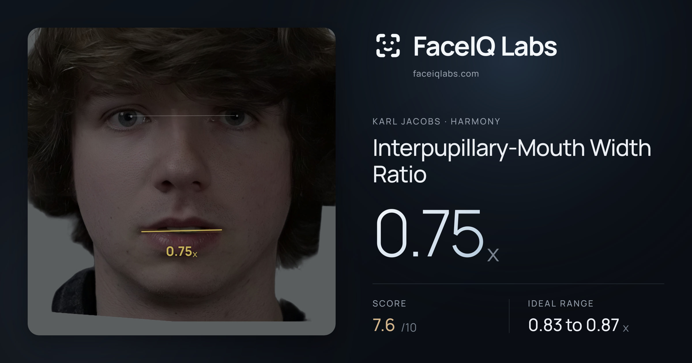 Karl Jacobs Interpupillary-Mouth Width Ratio: 0.75x, drawn on the photo