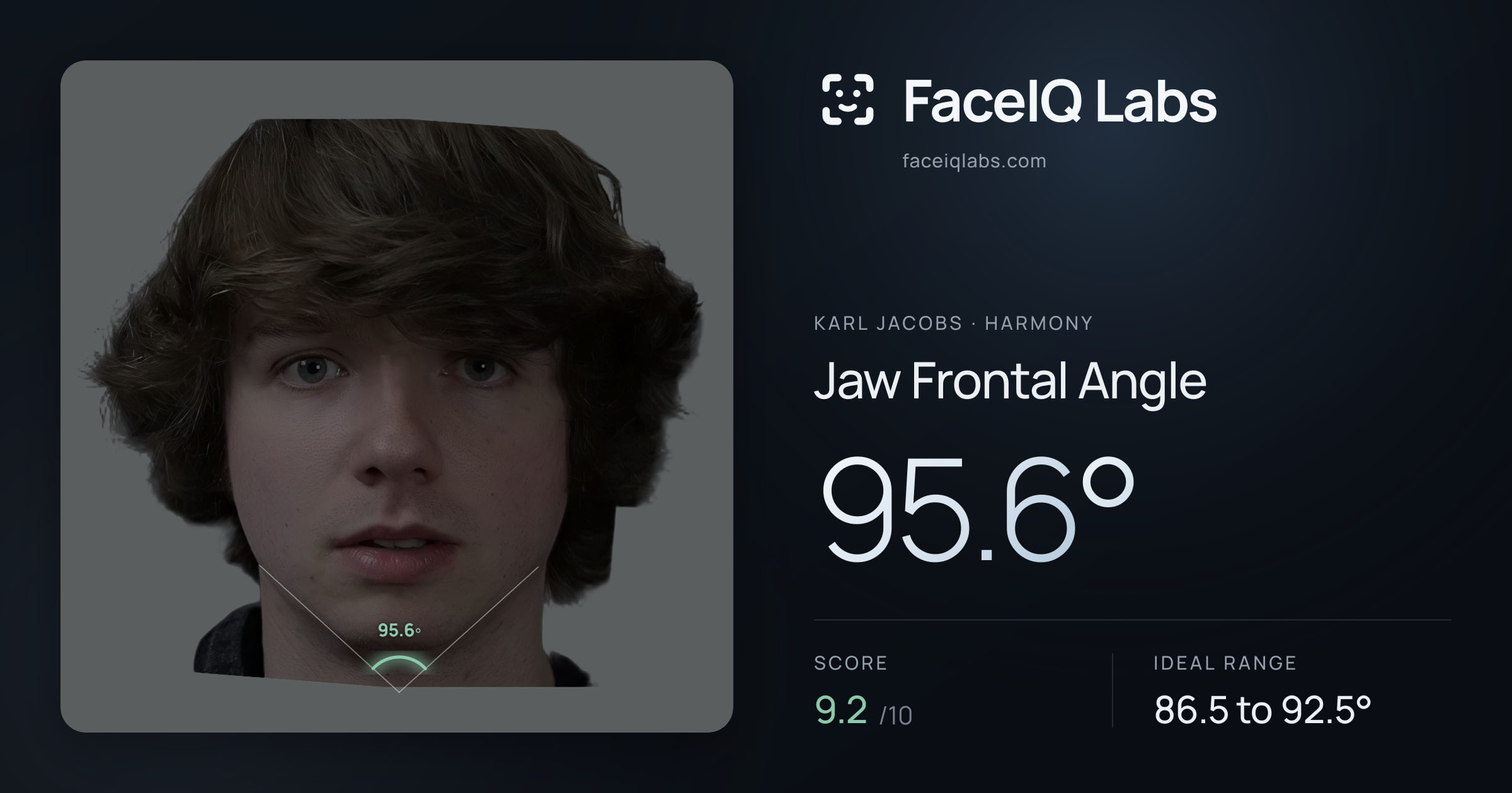 Karl Jacobs Jaw Frontal Angle: 95.6°, drawn on the photo