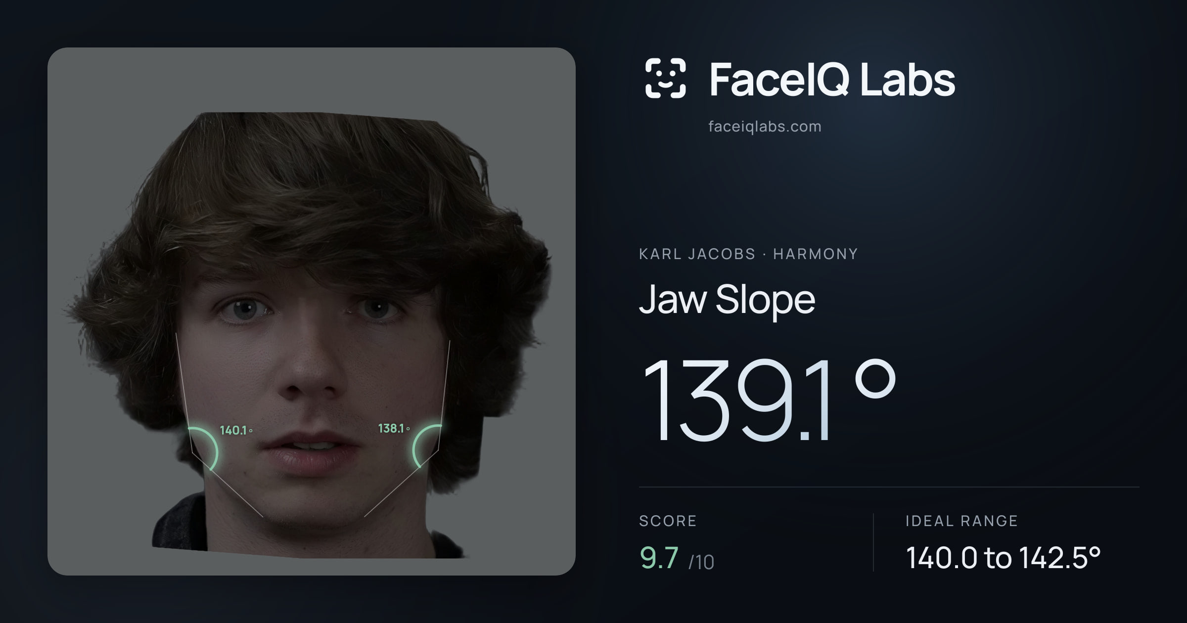 Karl Jacobs Jaw Slope: 139.1°, drawn on the photo