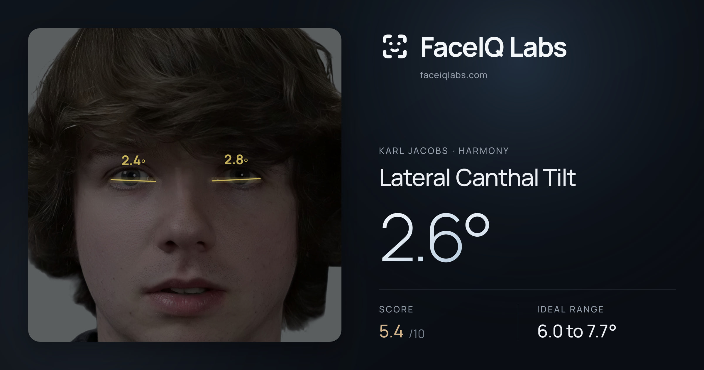 Karl Jacobs Lateral Canthal Tilt: 2.6°, drawn on the photo