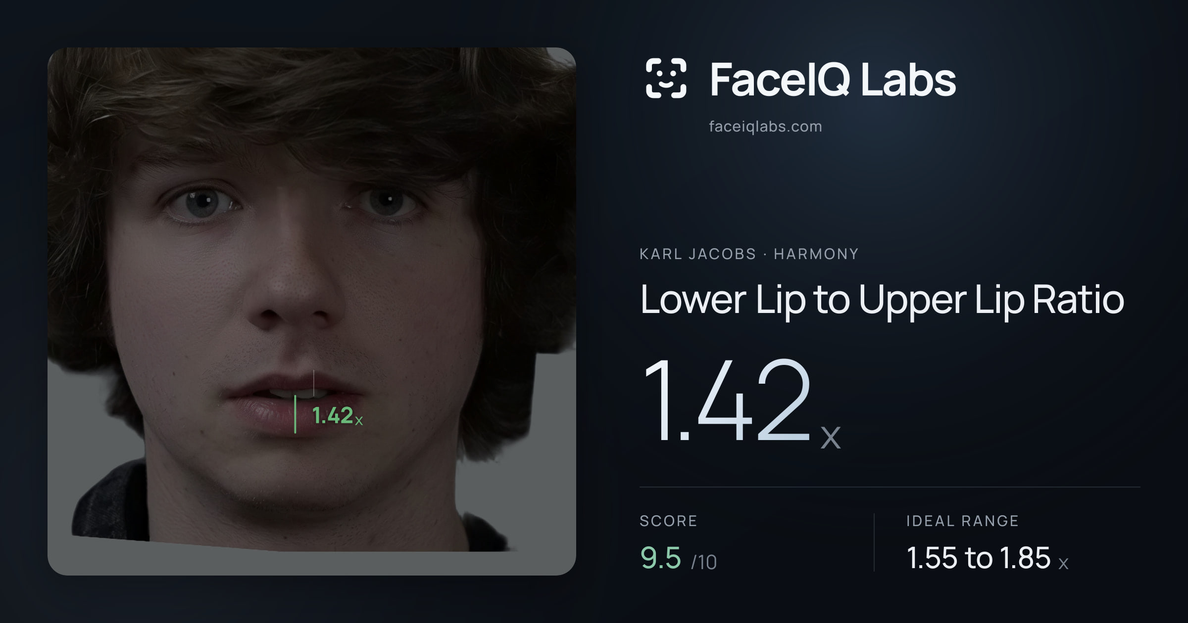 Karl Jacobs Lower Lip to Upper Lip Ratio: 1.42x, drawn on the photo