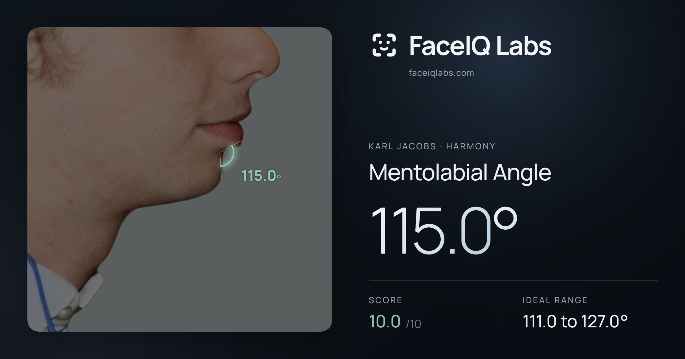 Karl Jacobs Mentolabial Angle: 115.0°, drawn on the photo