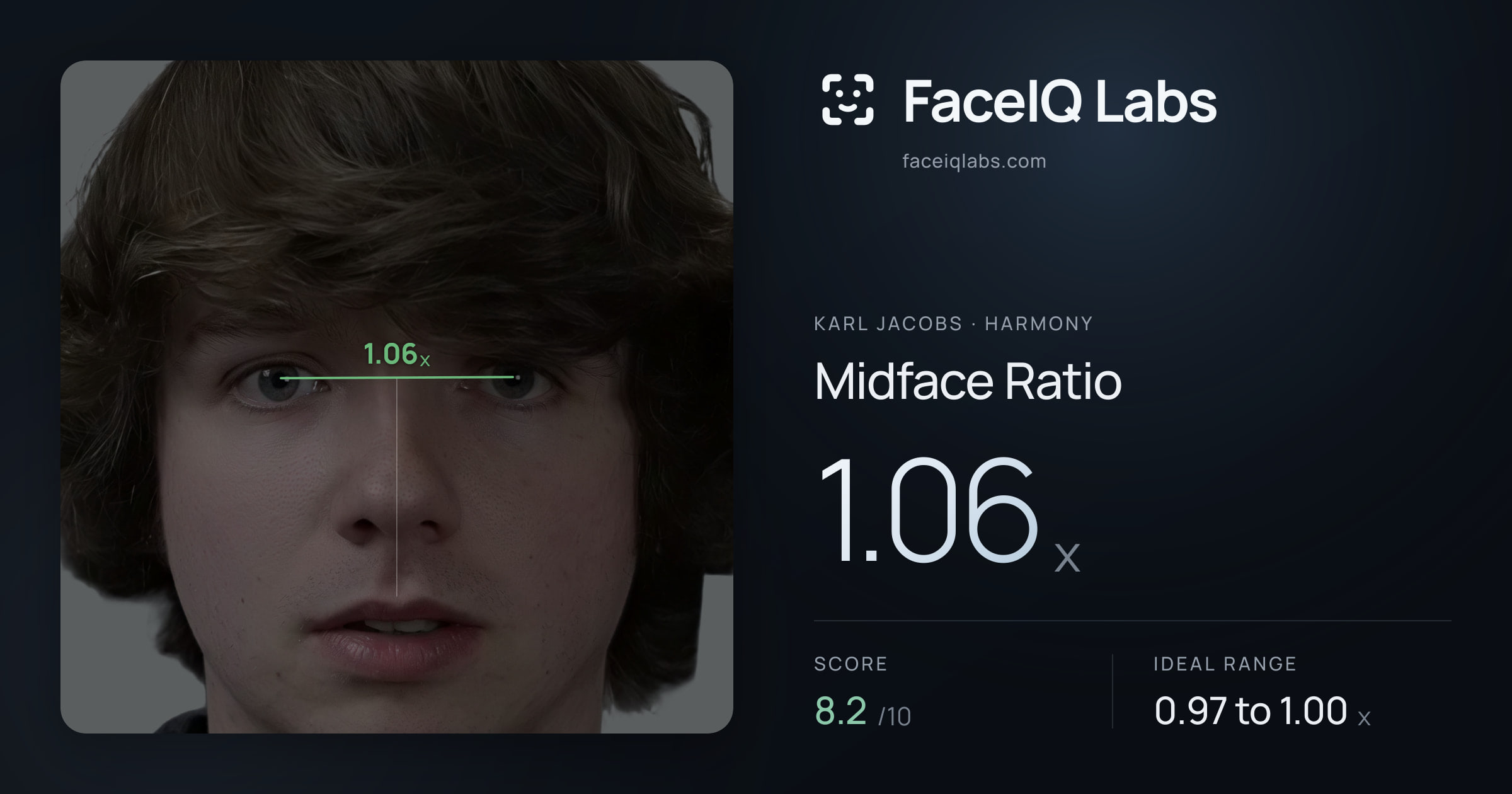 Karl Jacobs Midface Ratio: 1.06x, drawn on the photo